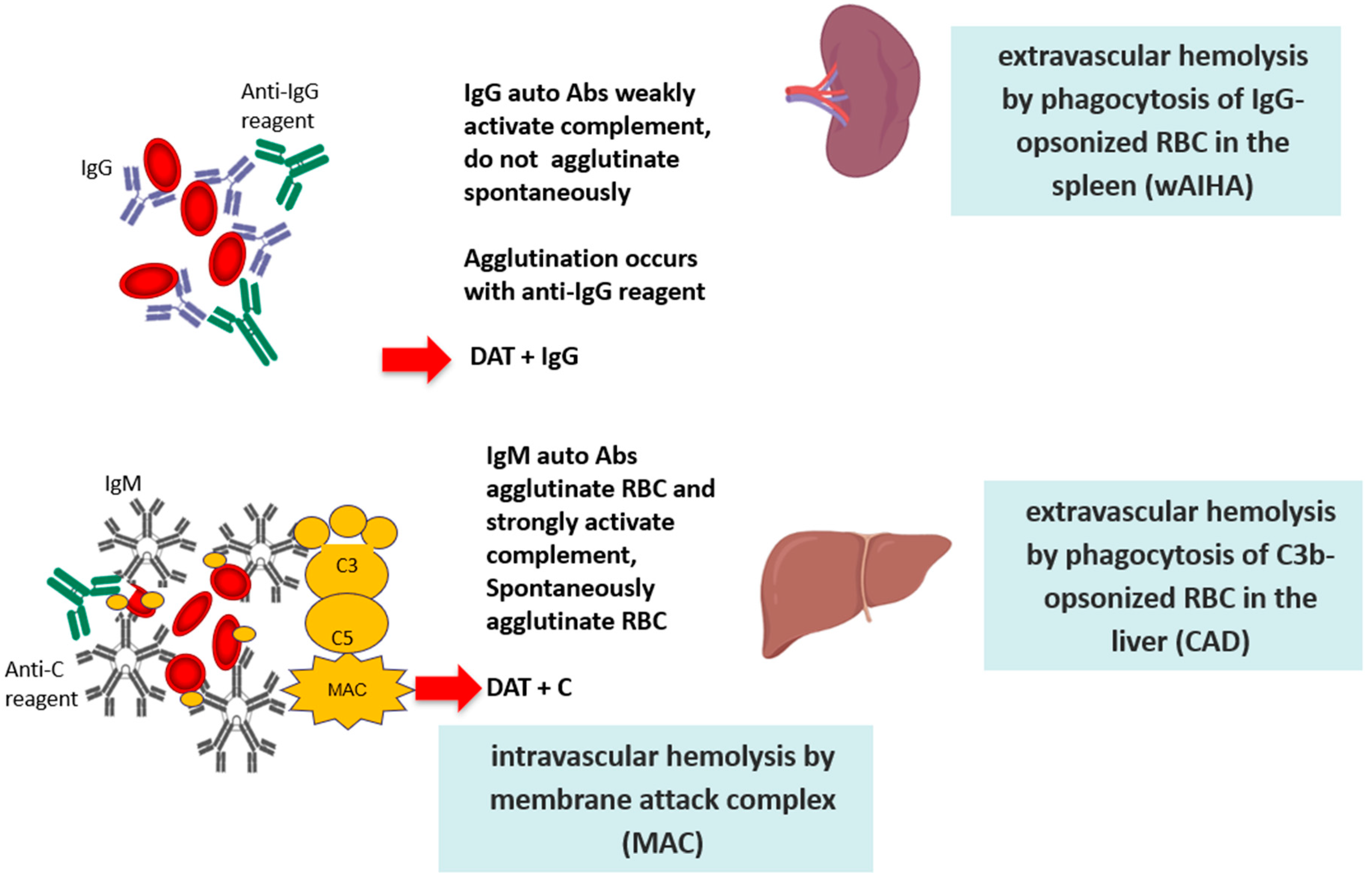JCM Free Full Text New Insights In Autoimmune Hemolytic Anemia From Pathogenesis To Therapy