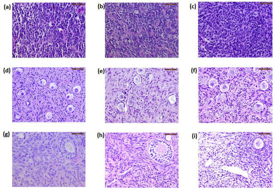 JCM | Free Full-Text | Is Ovarian Tissue Transplantation Safe in ...