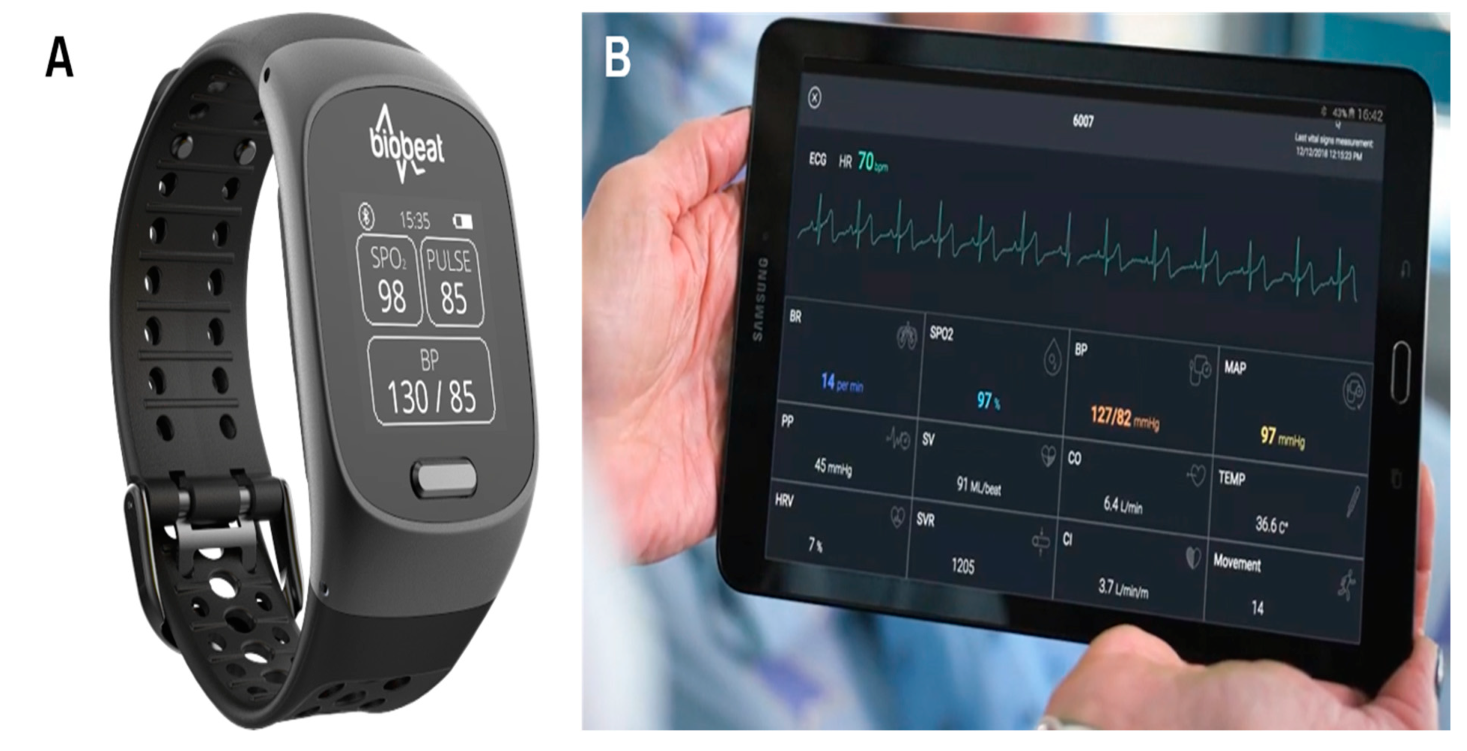 Biobeat Gets FDA Clearance for Wearable Blood Pressure Monitors