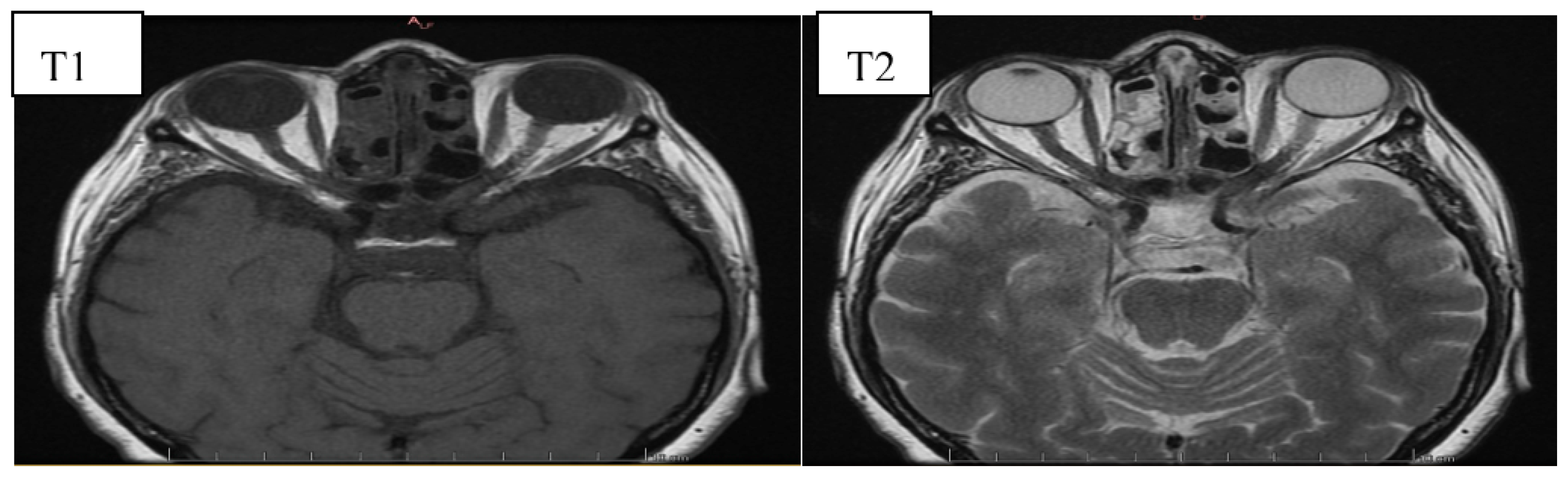 Jcm 10 00016 g004 Jcm 10 00016 g004