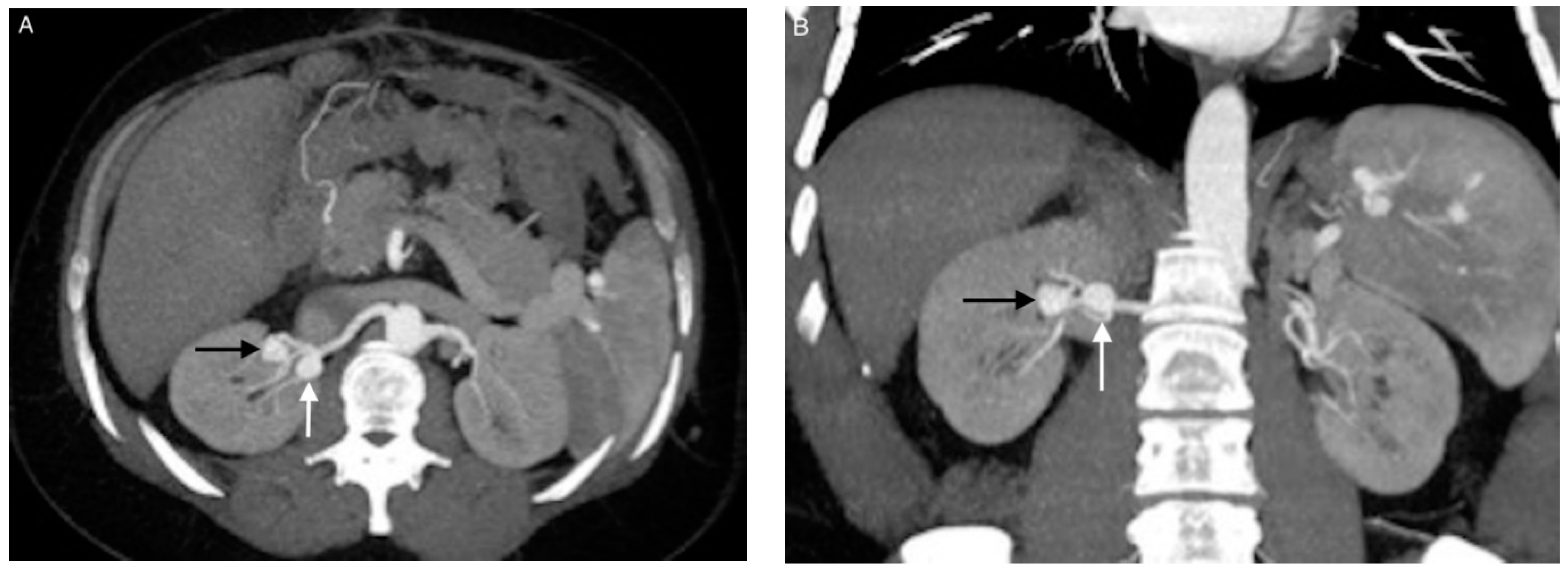 Jcm 10 00326 g001 Jcm 10 00326 g001