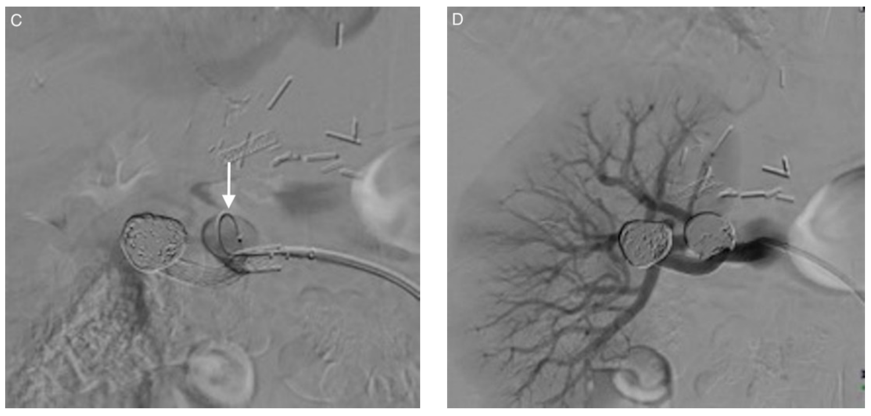 Jcm 10 00326 g003b Jcm 10 00326 g003b