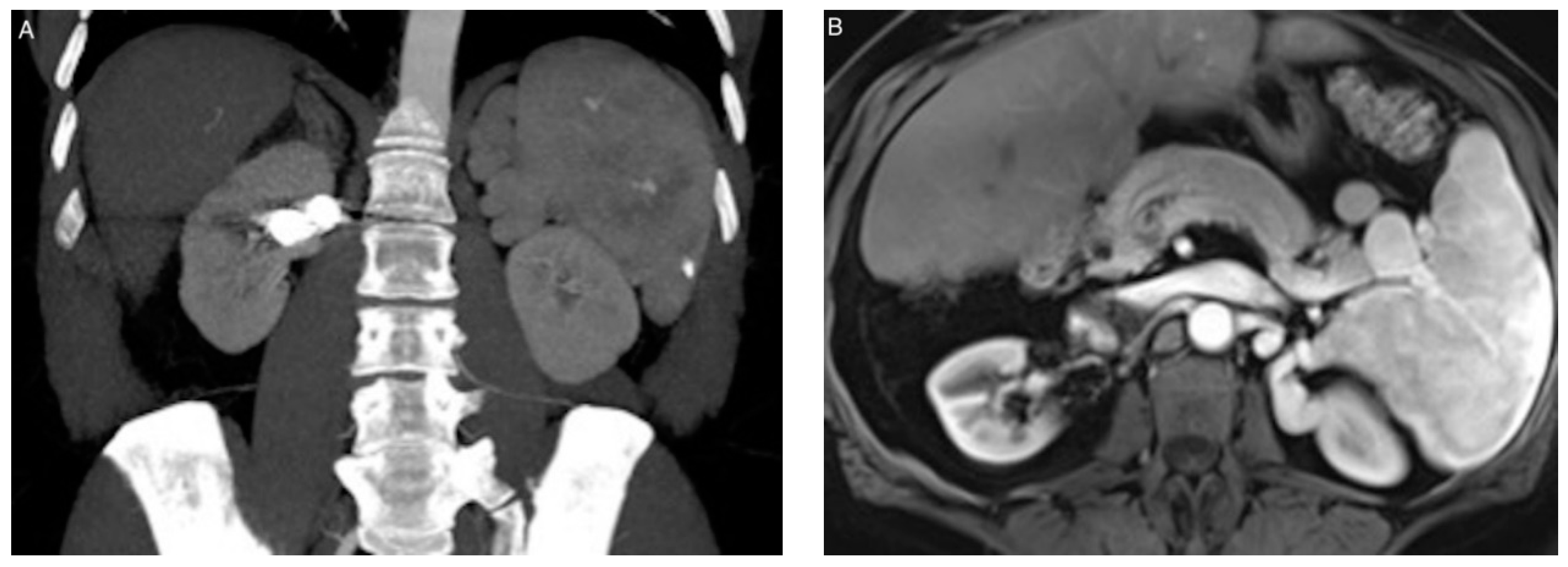 Jcm 10 00326 g004 Jcm 10 00326 g004