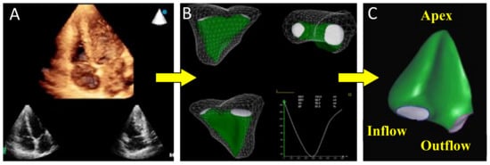 PDF) Novelties in 3D Transthoracic Echocardiography