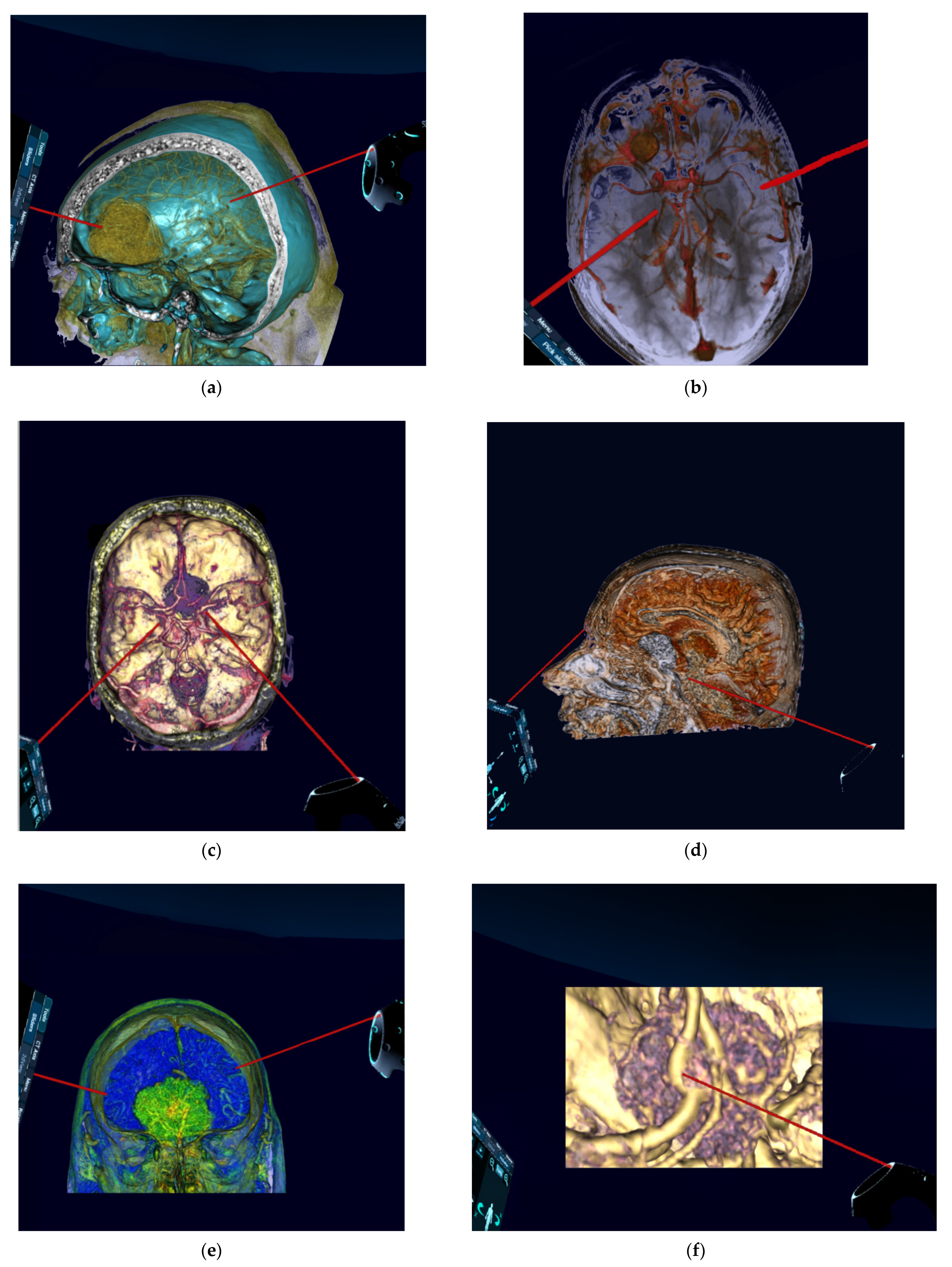 Jcm 10 00681 g004a Jcm 10 00681 g004a