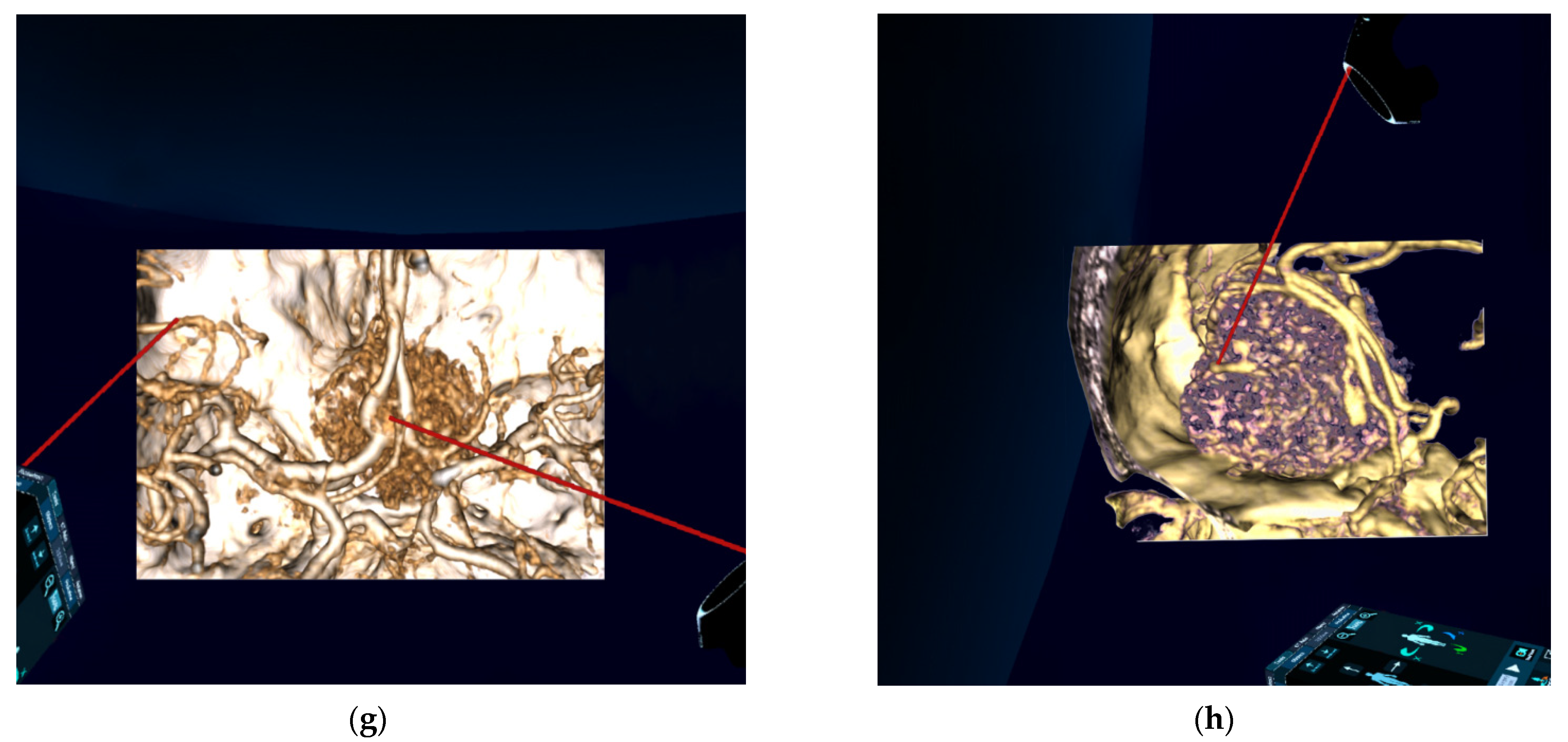 Jcm 10 00681 g004b Jcm 10 00681 g004b