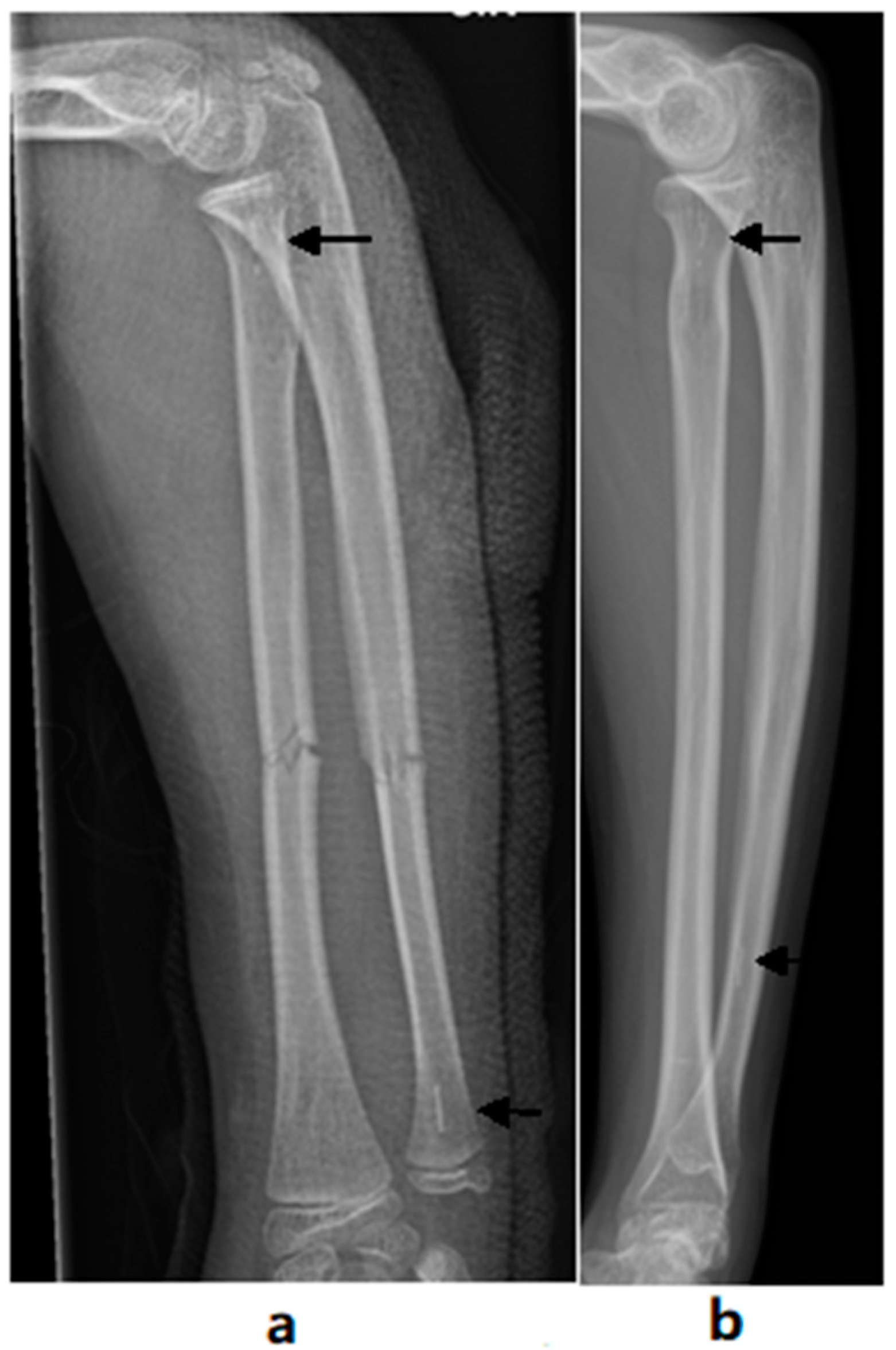 JCM | Free Full-Text | Randomized Controlled Trial Of The Clinical ...