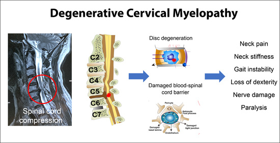 JCM | Free Full-Text | Degenerative Cervical Myelopathy: Insights into Its  Pathobiology and Molecular Mechanisms
