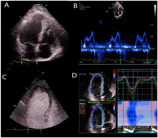 JCM | Free Full-Text | Artificial Intelligence (AI)-Empowered  Echocardiography Interpretation: A State-of-the-Art Review
