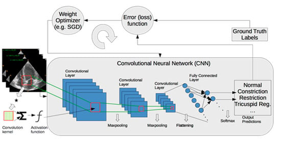 Achieving zero variability echocardiographic analysis in cardio-oncology  with AI-powered EchoGo from Ultromics - Ultromics