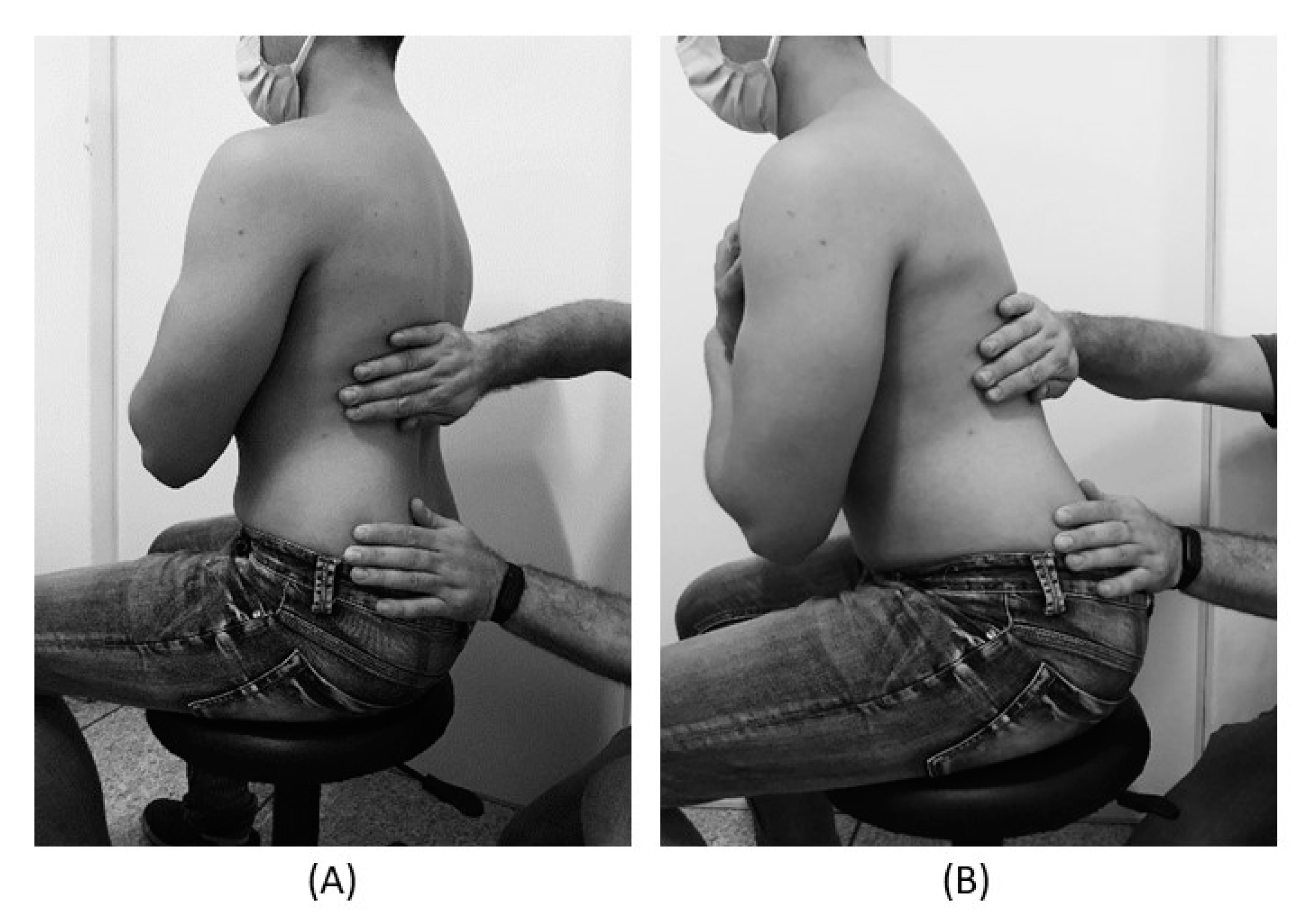 JCM | Free Full-Text | Can a Single Trial of a Thoracolumbar Myofascial  Release Technique Reduce Pain and Disability in Chronic Low Back Pain? A  Randomized Balanced Crossover Study