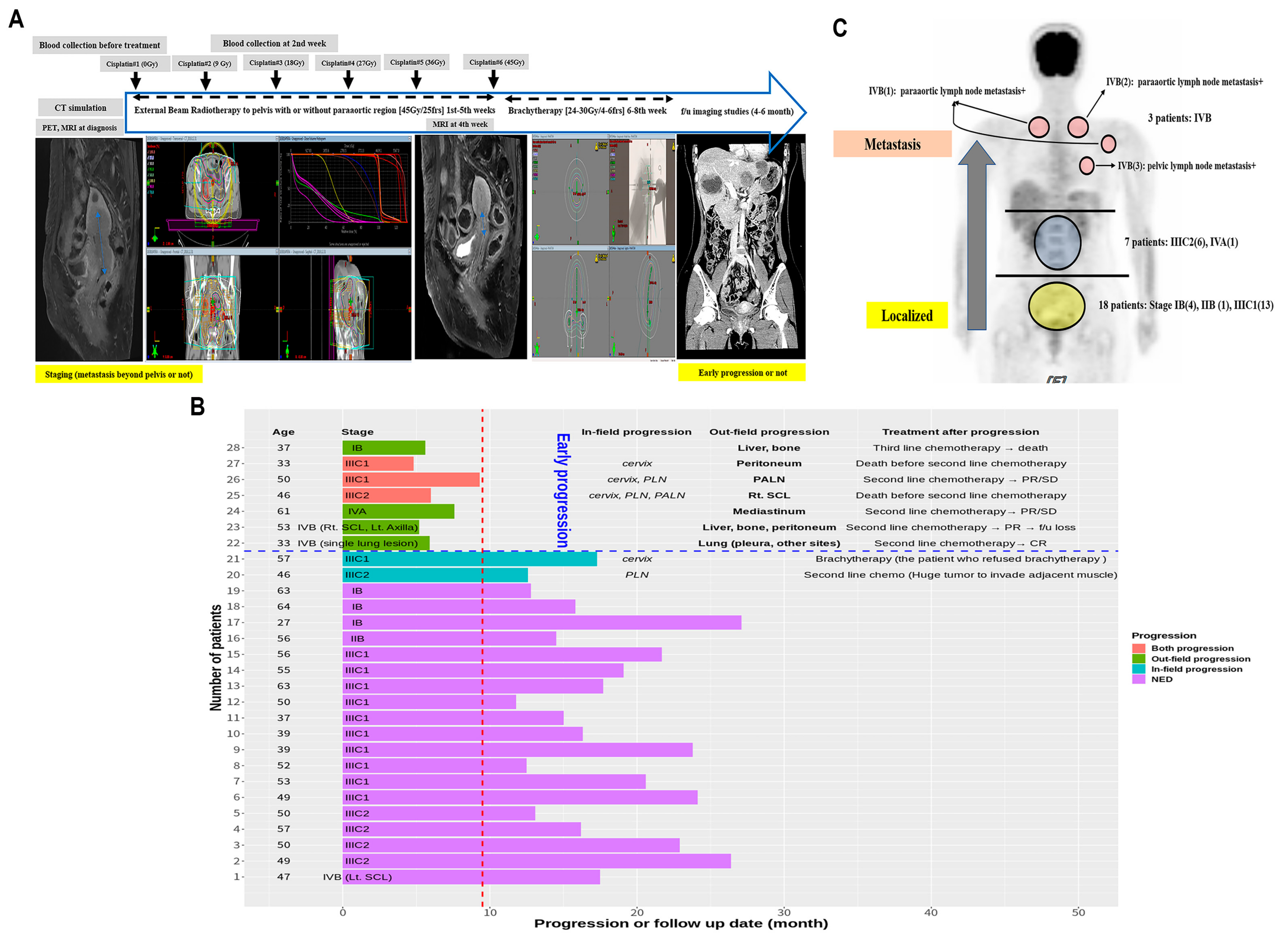 JCM | Free Full-Text | Plasma Exosomal miRNA Levels after Radiotherapy Are  Associated with Early Progression and Metastasis of Cervical Cancer: A  Pilot Study