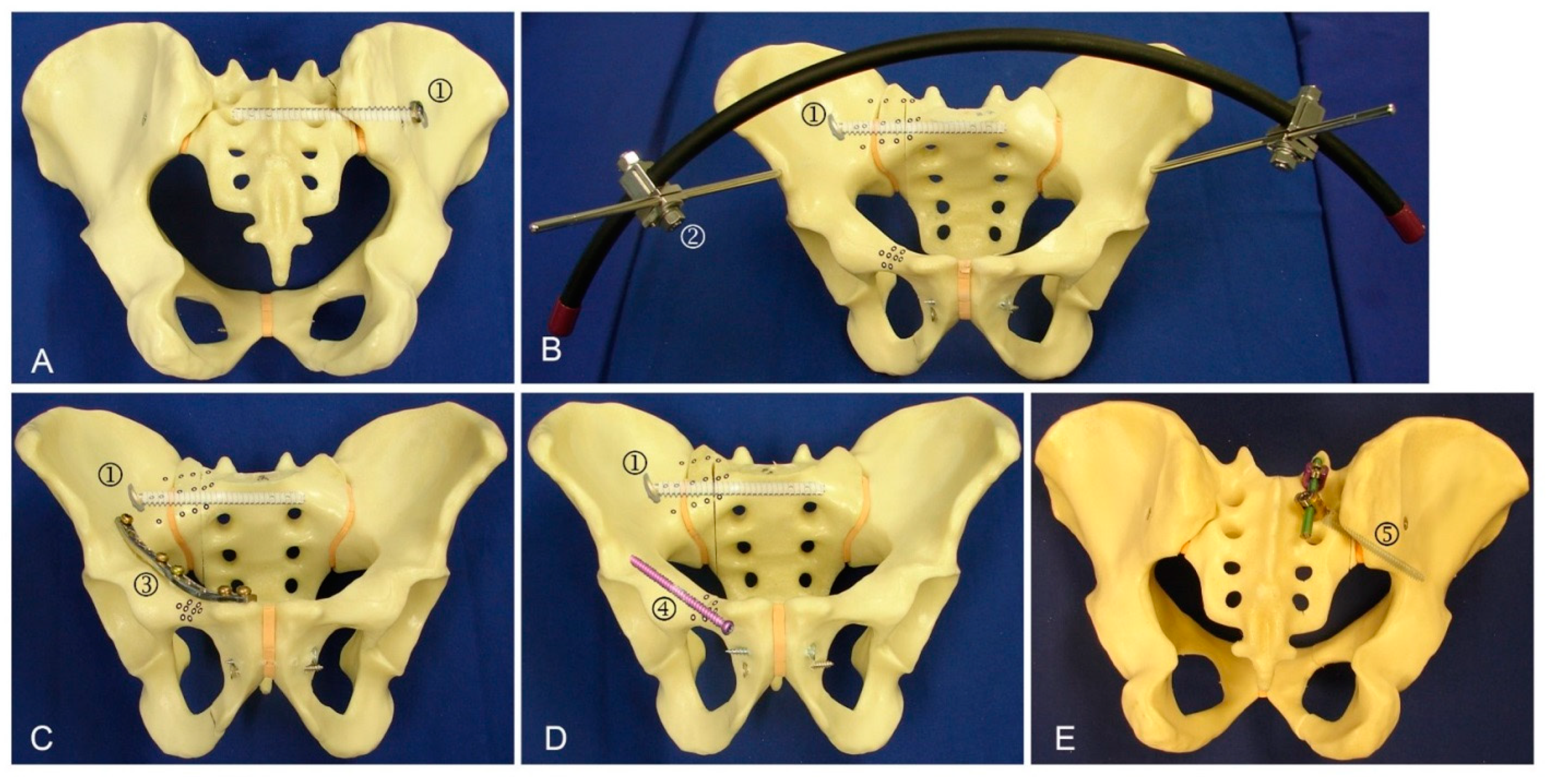 Jcm 10 02326 g003 Jcm 10 02326 g003