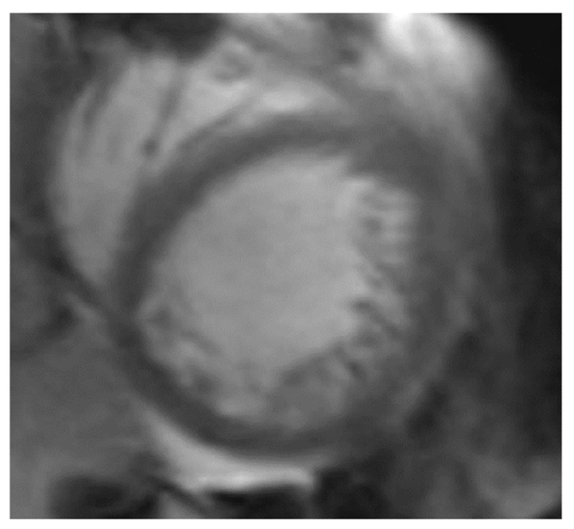 Jcm 10 02457 g003 Jcm 10 02457 g003