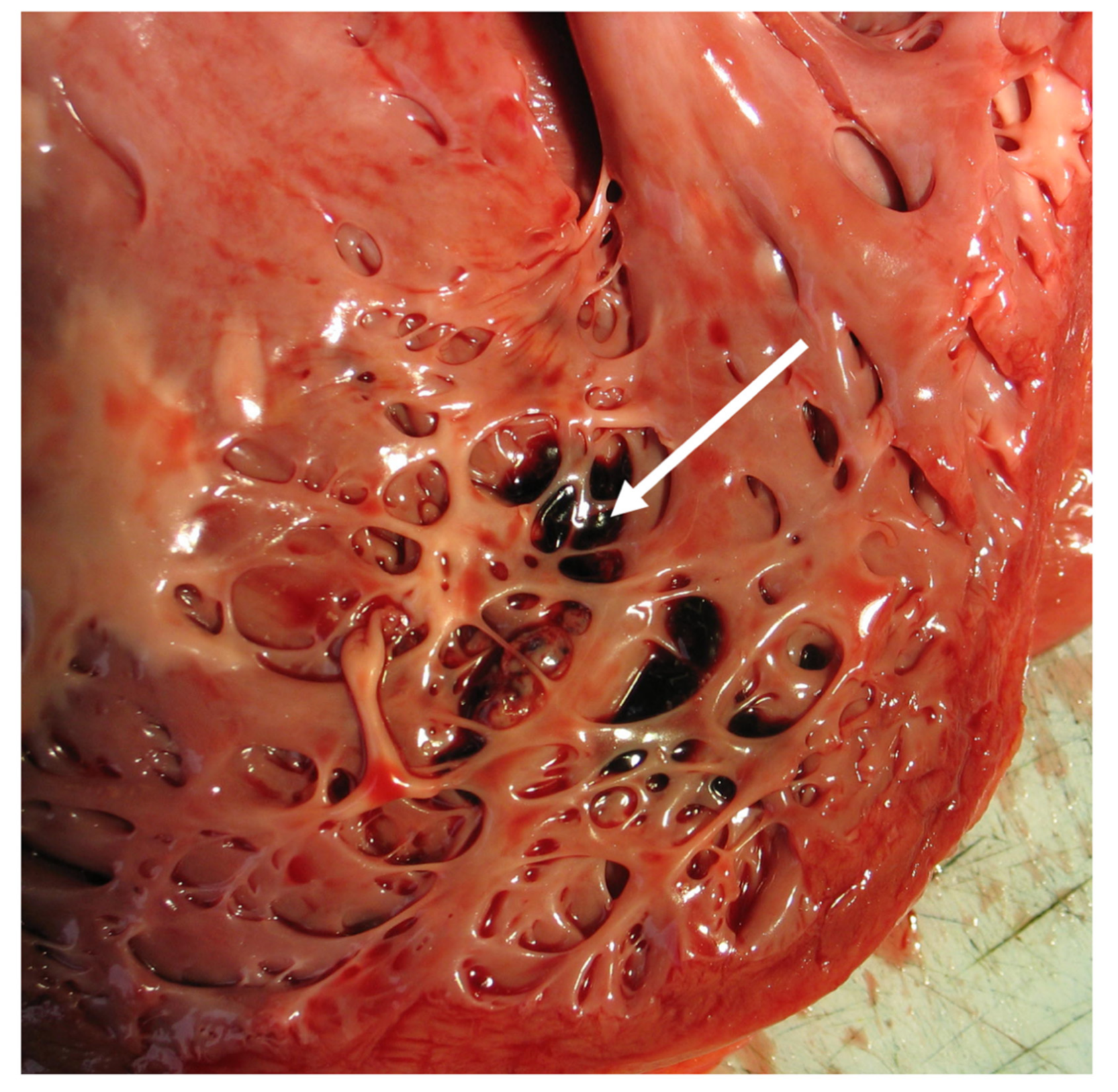 Jcm 10 02457 g005 Jcm 10 02457 g005