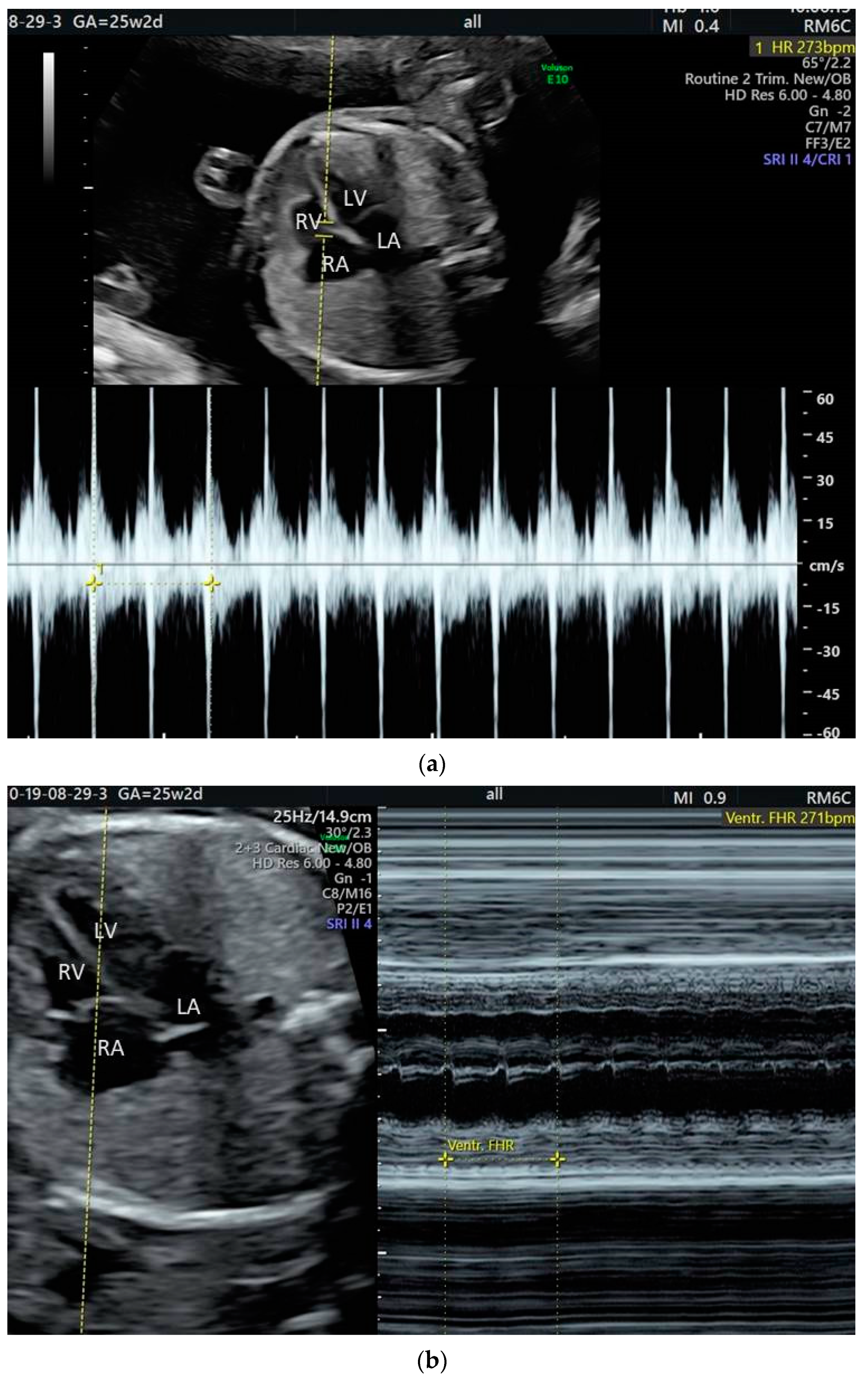 Jcm 10 02510 g004 Jcm 10 02510 g004