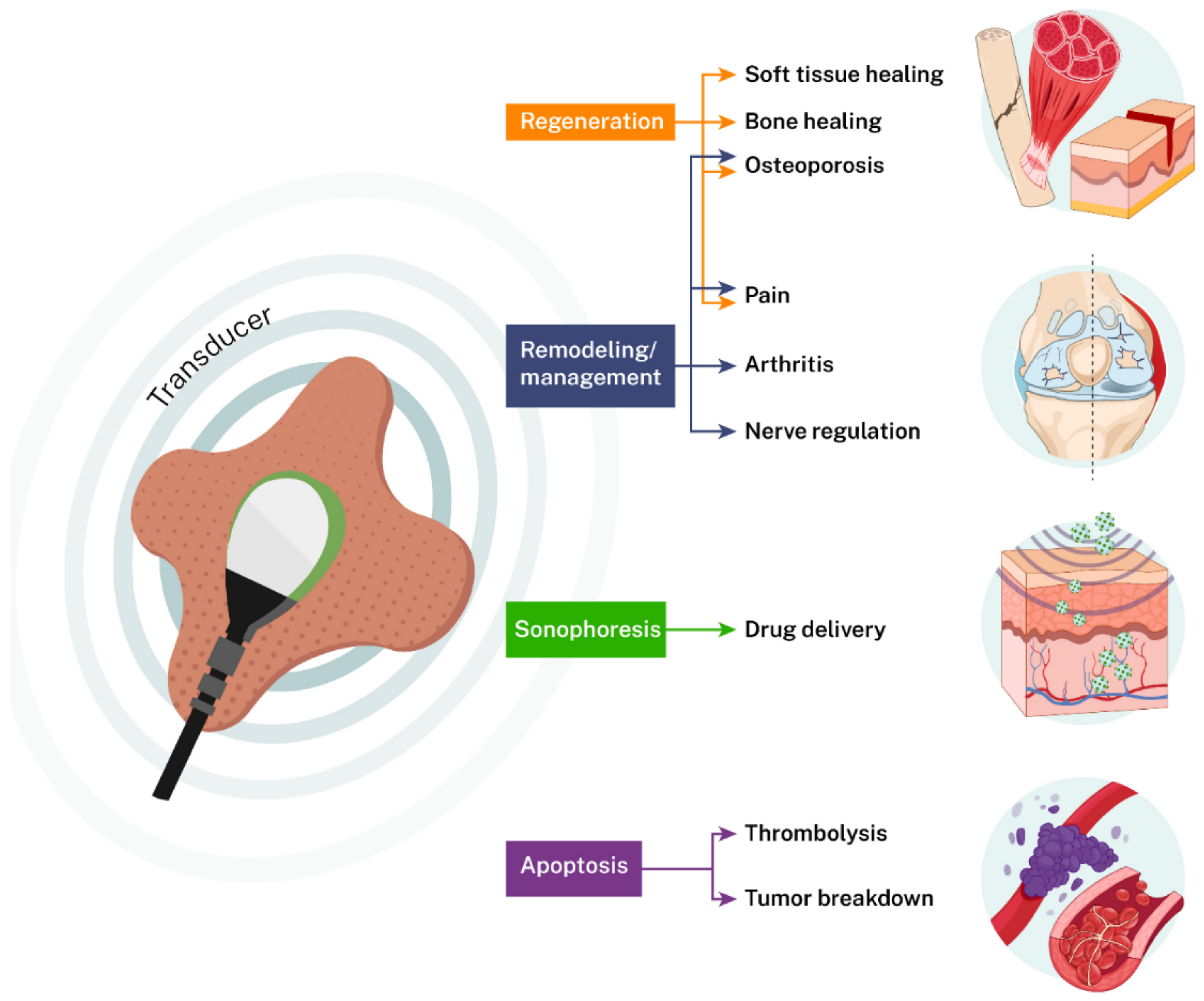 Low-intensity pulsed ultrasound for treating delayed union