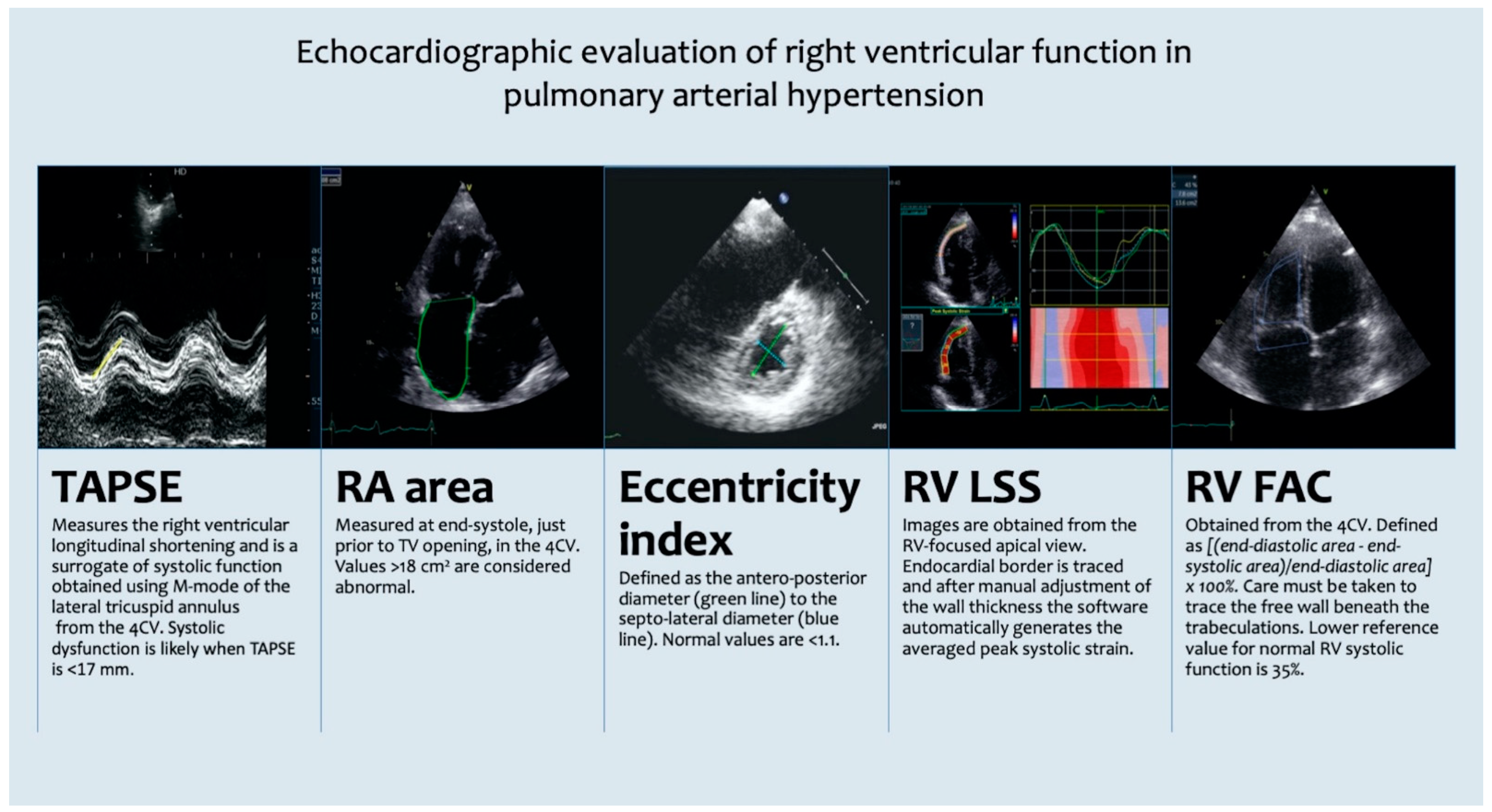 JCM | Free Full-Text | Echocardiography in Pulmonary Arterial Hypertension:  Is It Time to Reconsider Its Prognostic Utility?