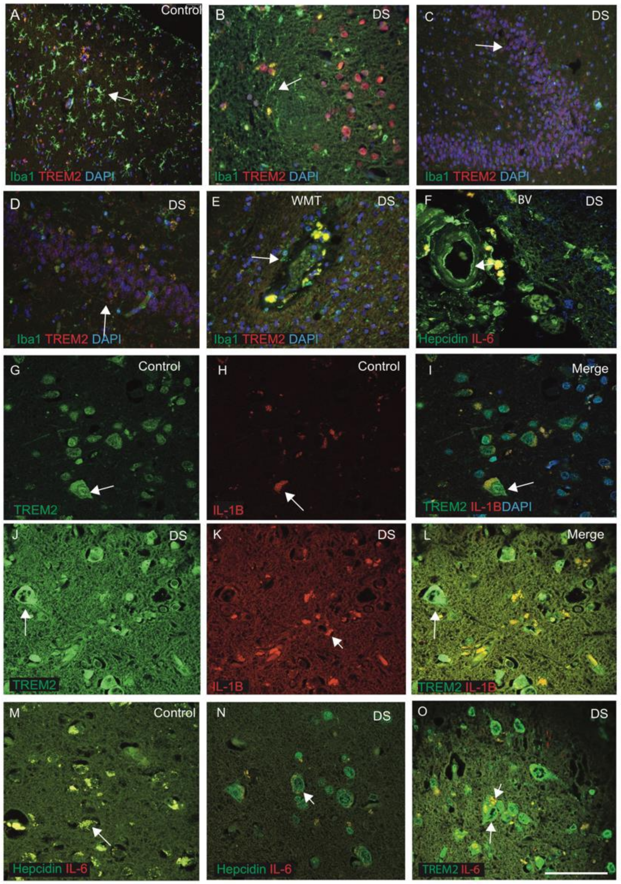 Jcm 10 02909 g005 Jcm 10 02909 g005