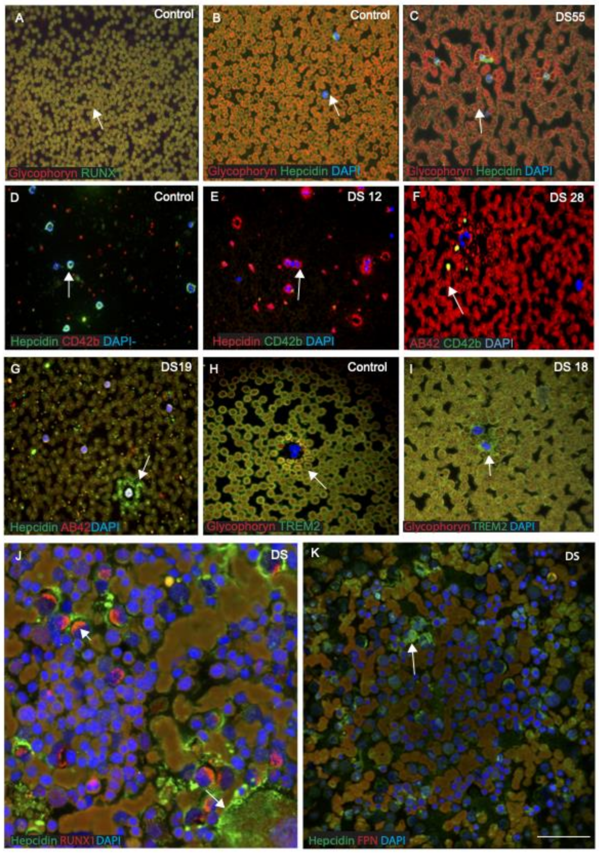 Jcm 10 02909 g008 Jcm 10 02909 g008