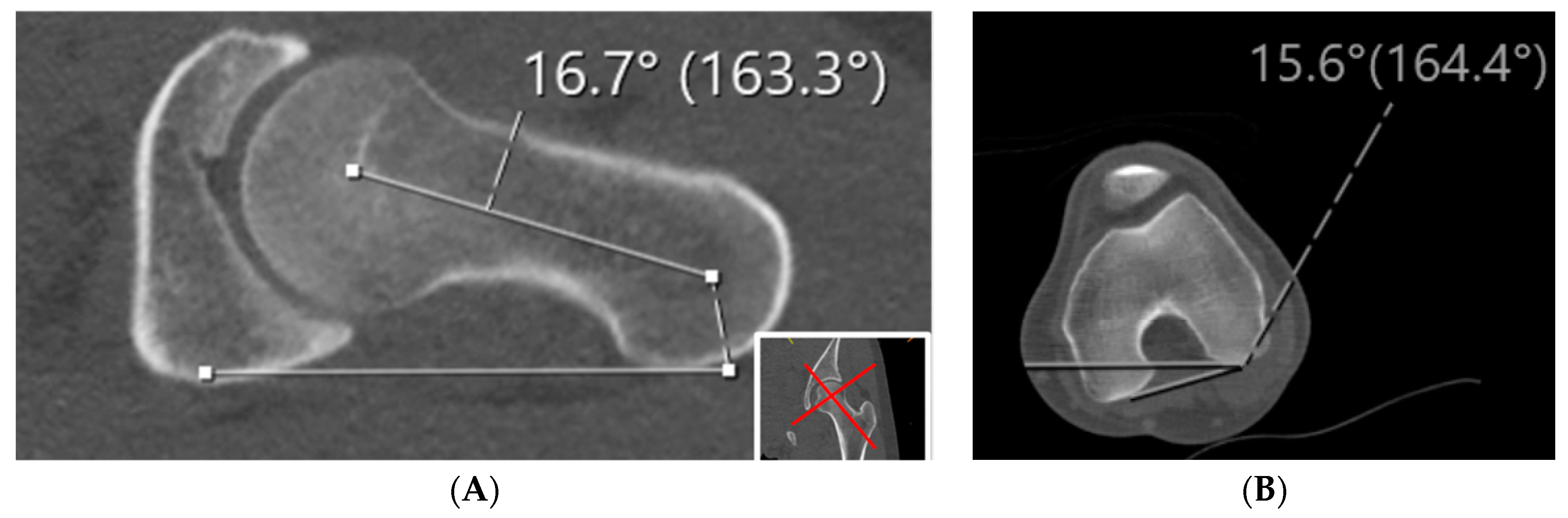 Jcm 10 03035 g005