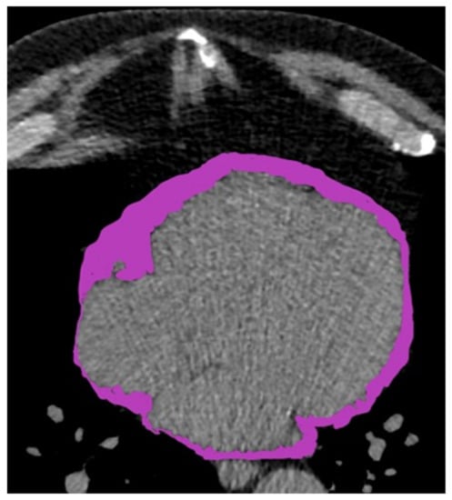 JCM | Special Issue : The Risk Factors Of Cardiovascular Diseases