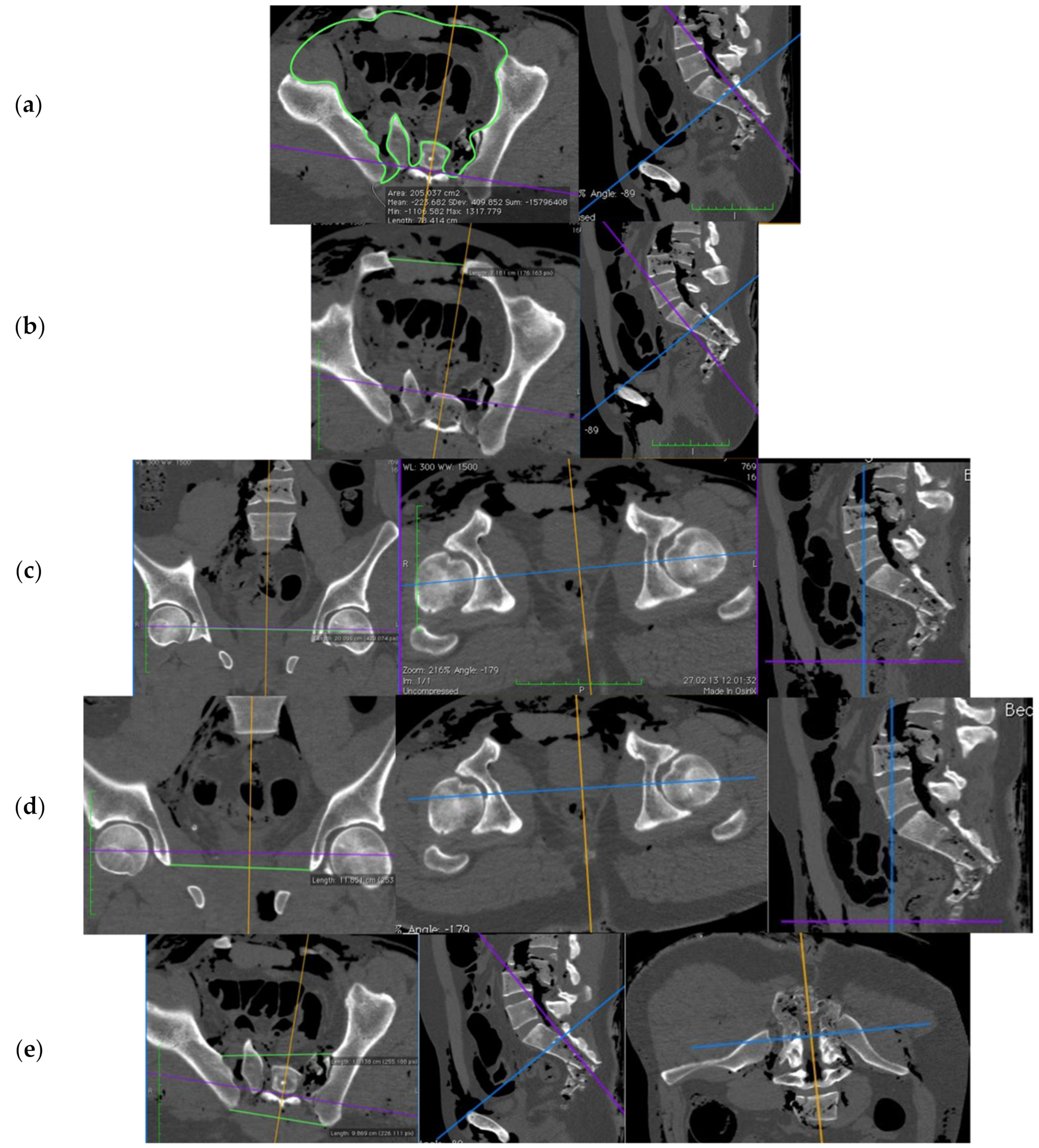 Jcm 10 04348 g002 Jcm 10 04348 g002