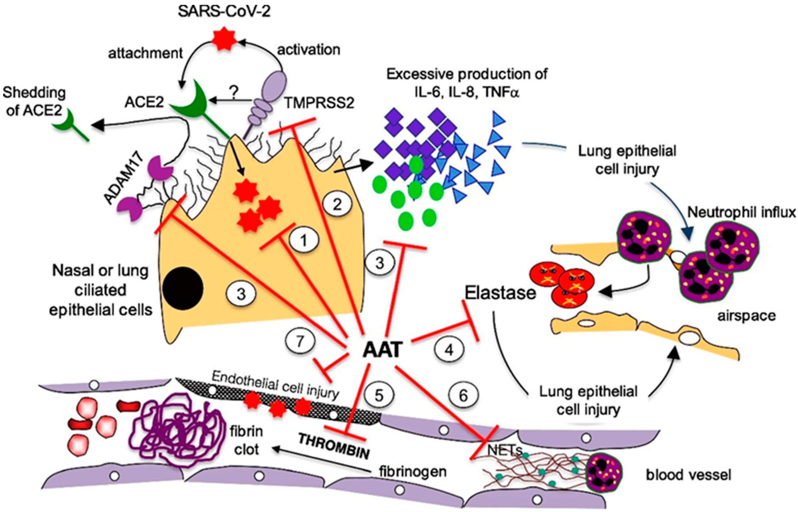 Alpha 1 Antitrypsin is an Inhibitor of the SARS-CoV-2–Priming