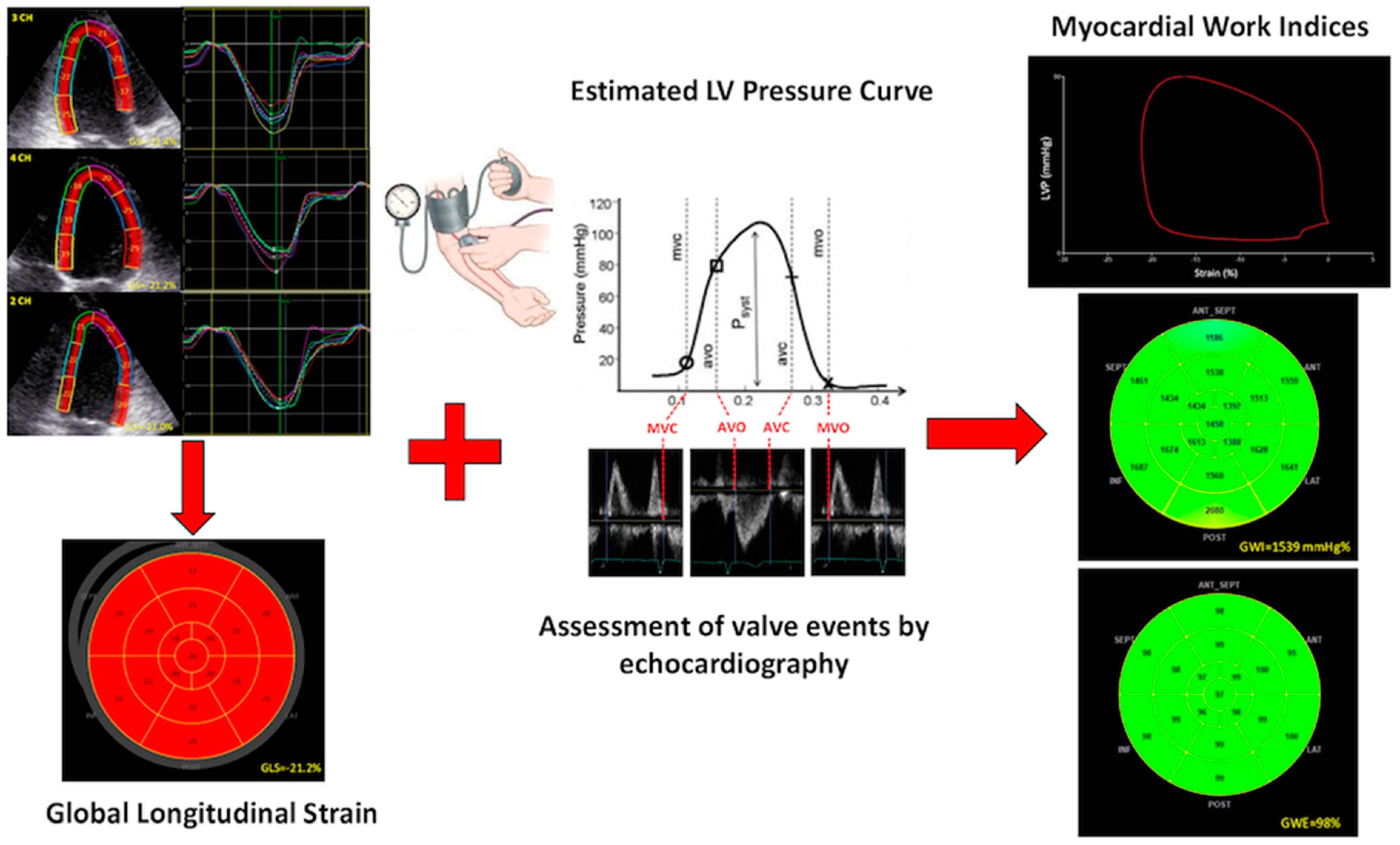Two-dimensional Echocardiographic Assessment of Myocardial Strain:  Important Echocardiographic Parameter Readily Useful in Clinical Field. -  Abstract - Europe PMC