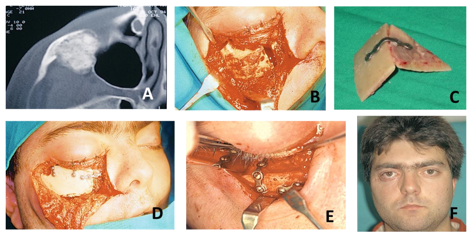 Jcm 10 04565 g006 Jcm 10 04565 g006