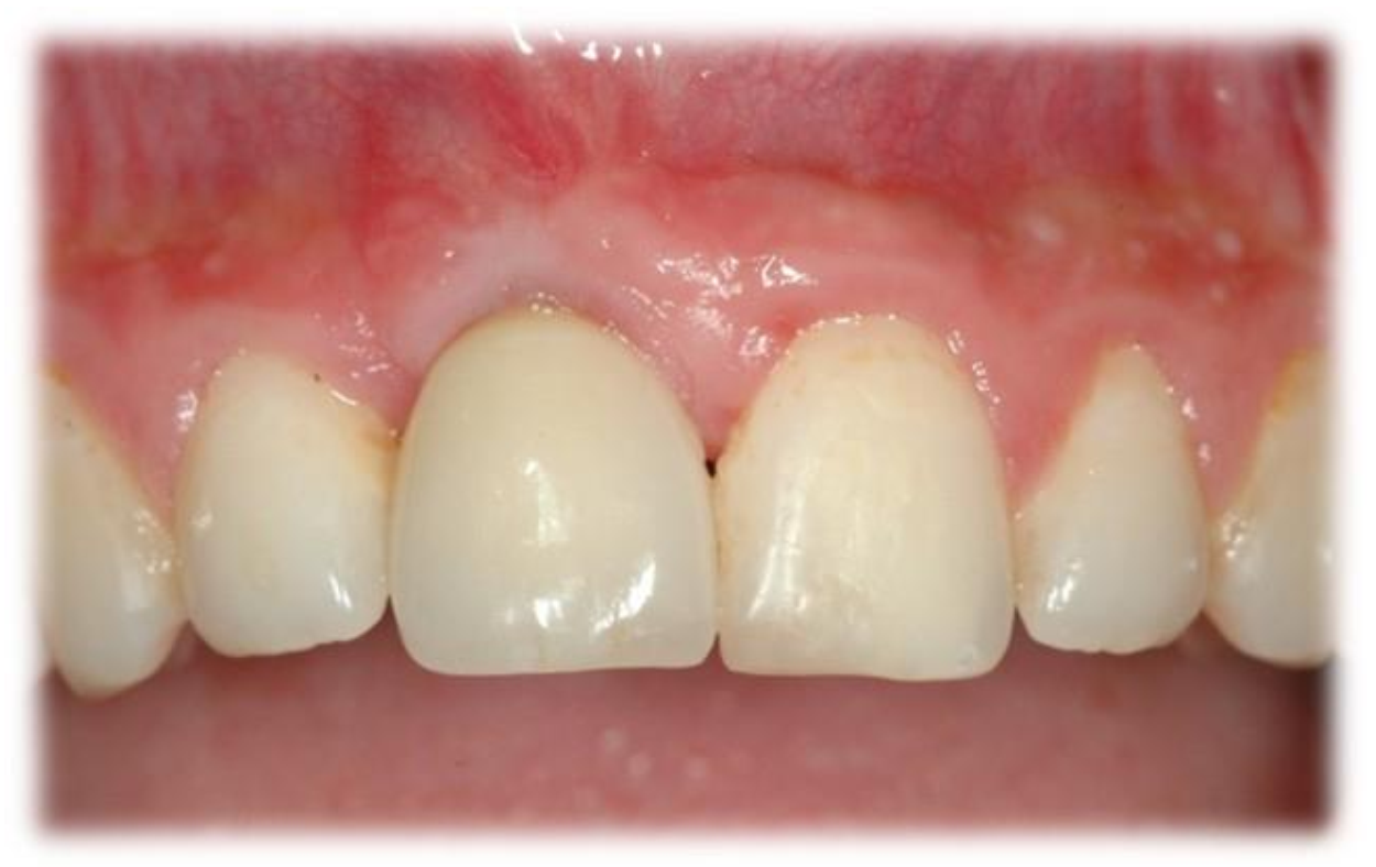 Jcm 10 04635 g005 Jcm 10 04635 g005