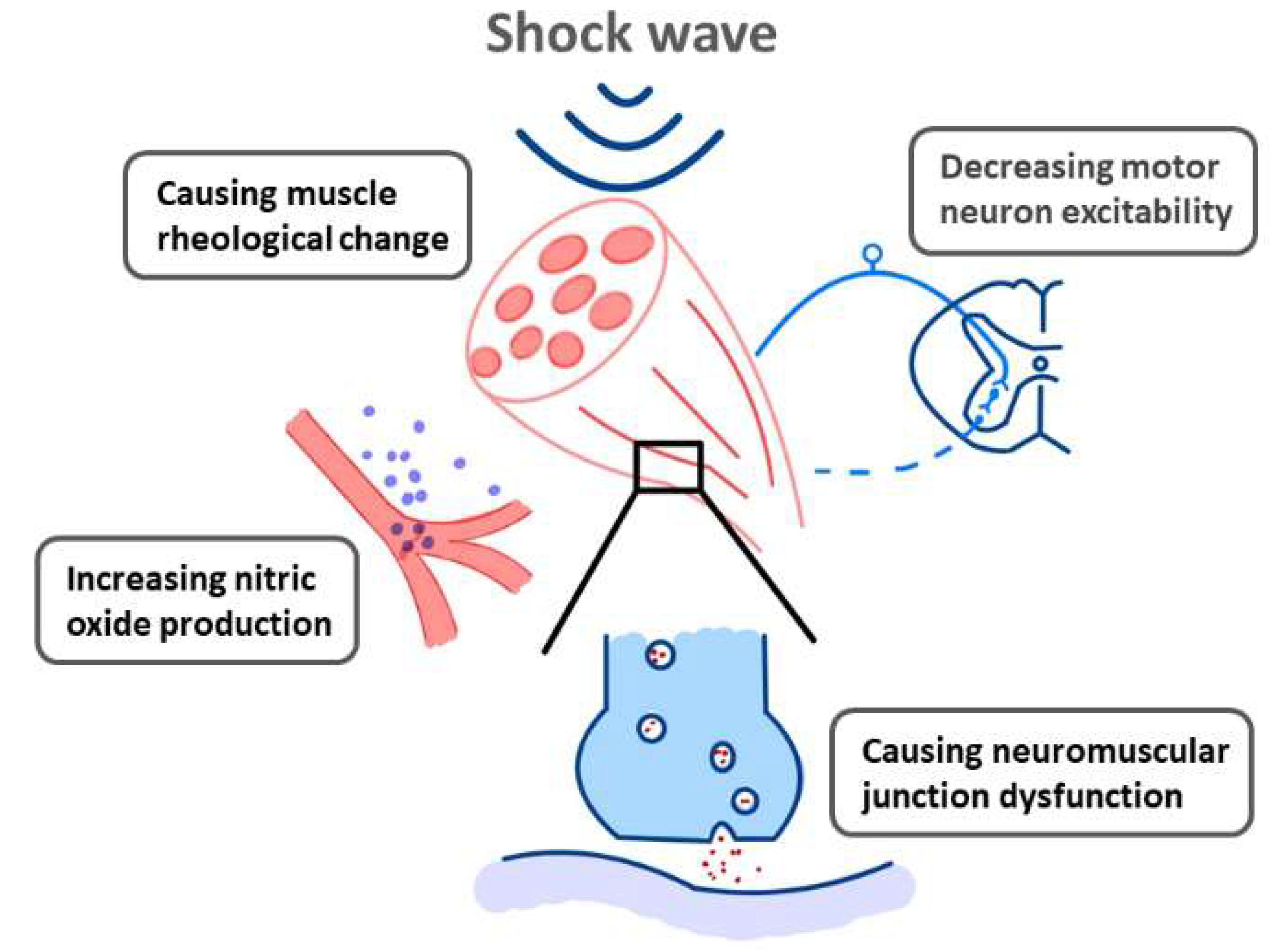 The Effectiveness Of Radial Extracorporeal Shock Wave Therapy In Patie