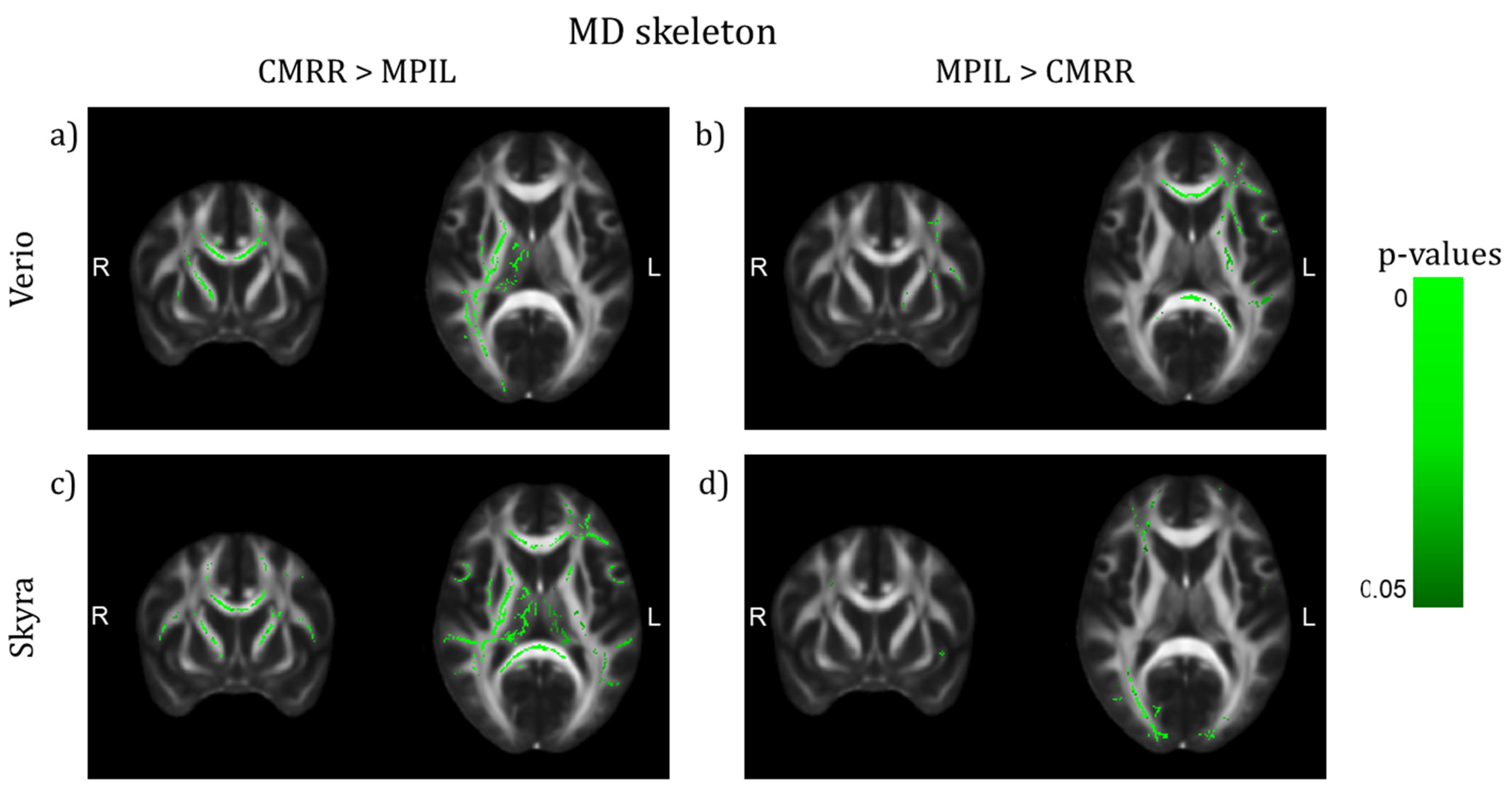 JCM | Free Full-Text | Same Brain, Different Look?—The Impact of Scanner,  Sequence and Preprocessing on Diffusion Imaging Outcome Parameters