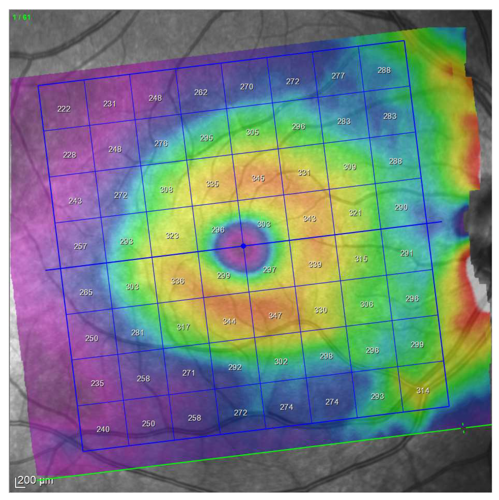 Jcm 10 05009 g002 Jcm 10 05009 g002