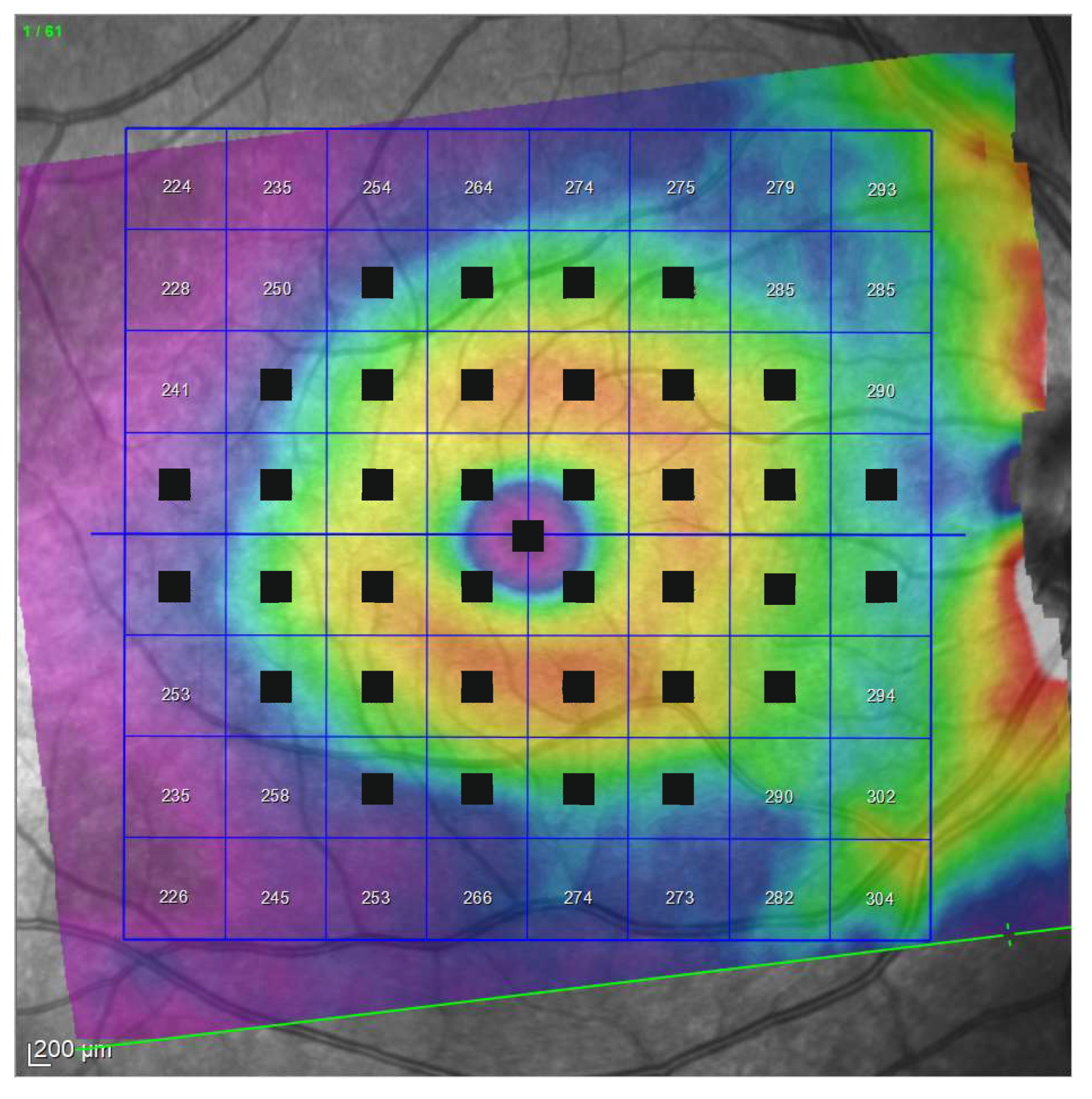Jcm 10 05009 g004 Jcm 10 05009 g004