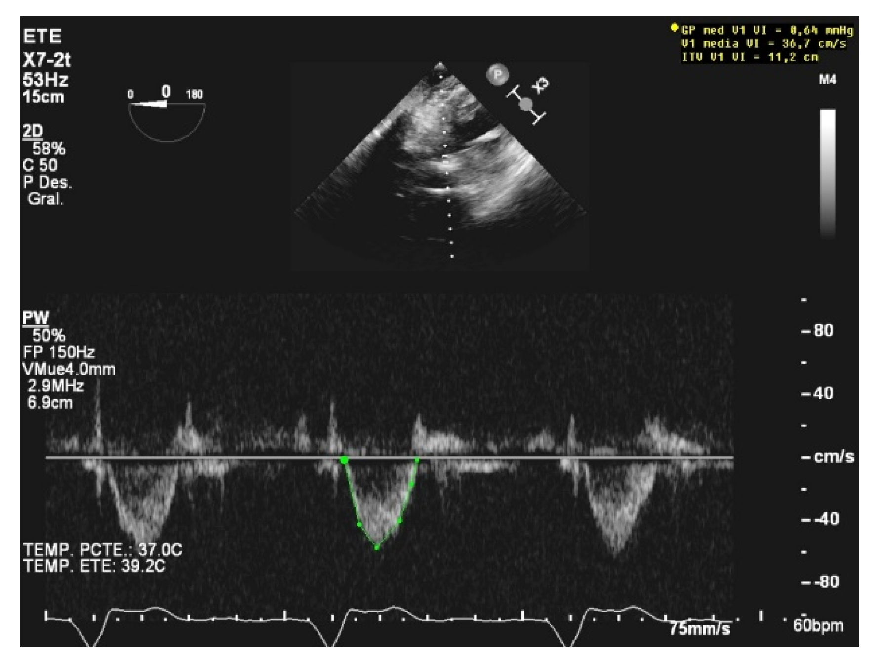 JCM | Free Full-Text | Ultrasound Assessment in Cardiogenic Shock ...