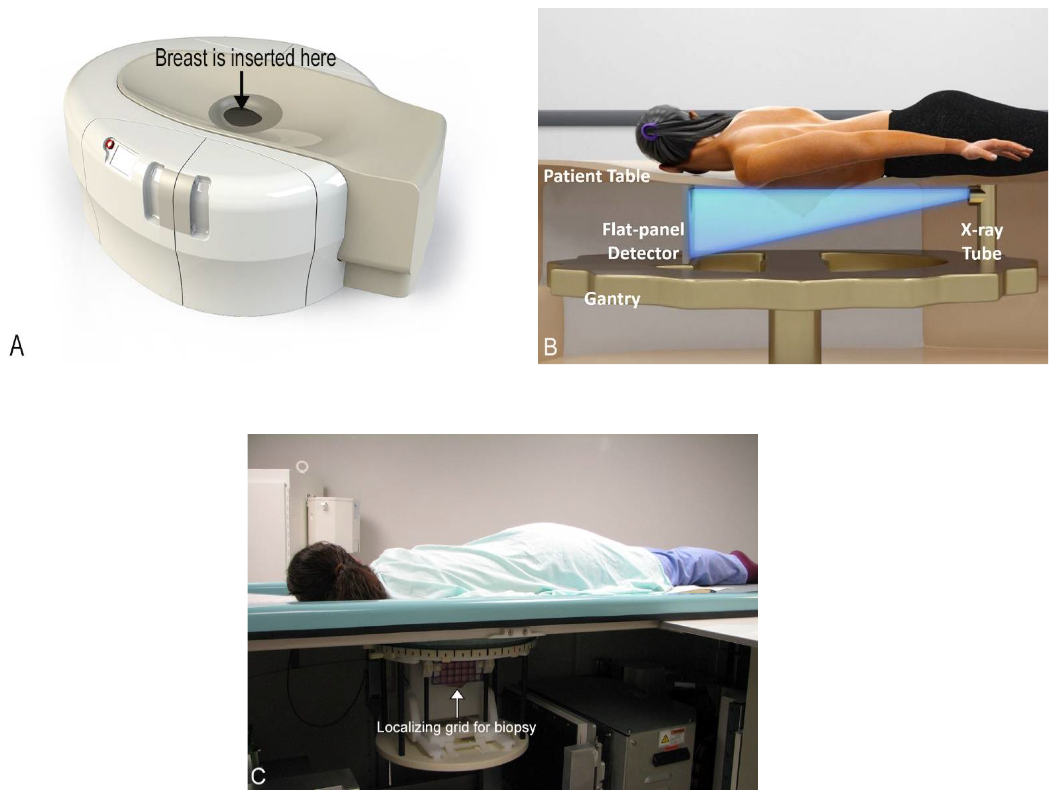 Jcm Free Full Text Cone Beam Breast Computed Tomography Time For A New Paradigm In Breast