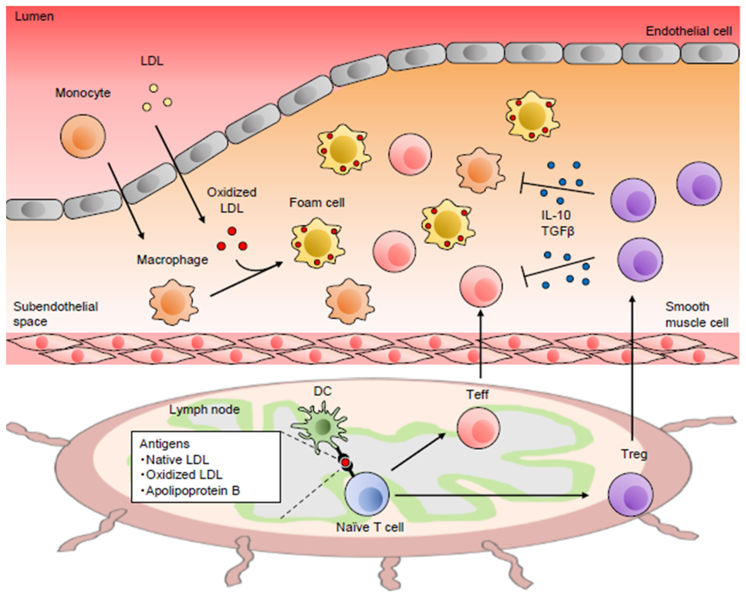 JCM | Free Full-Text | Recent Advances on the Role and Therapeutic  Potential of Regulatory T Cells in Atherosclerosis | HTML