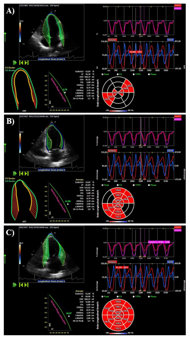Advances in echocardiography: global longitudinal strain, intra
