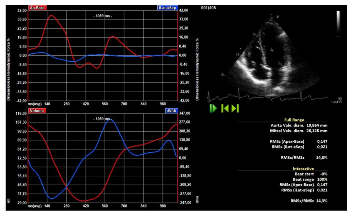 Normal Left Ventricular Mechanics by Two-dimensional Speckle-tracking  Echocardiography. Reference Values in Healthy Adults