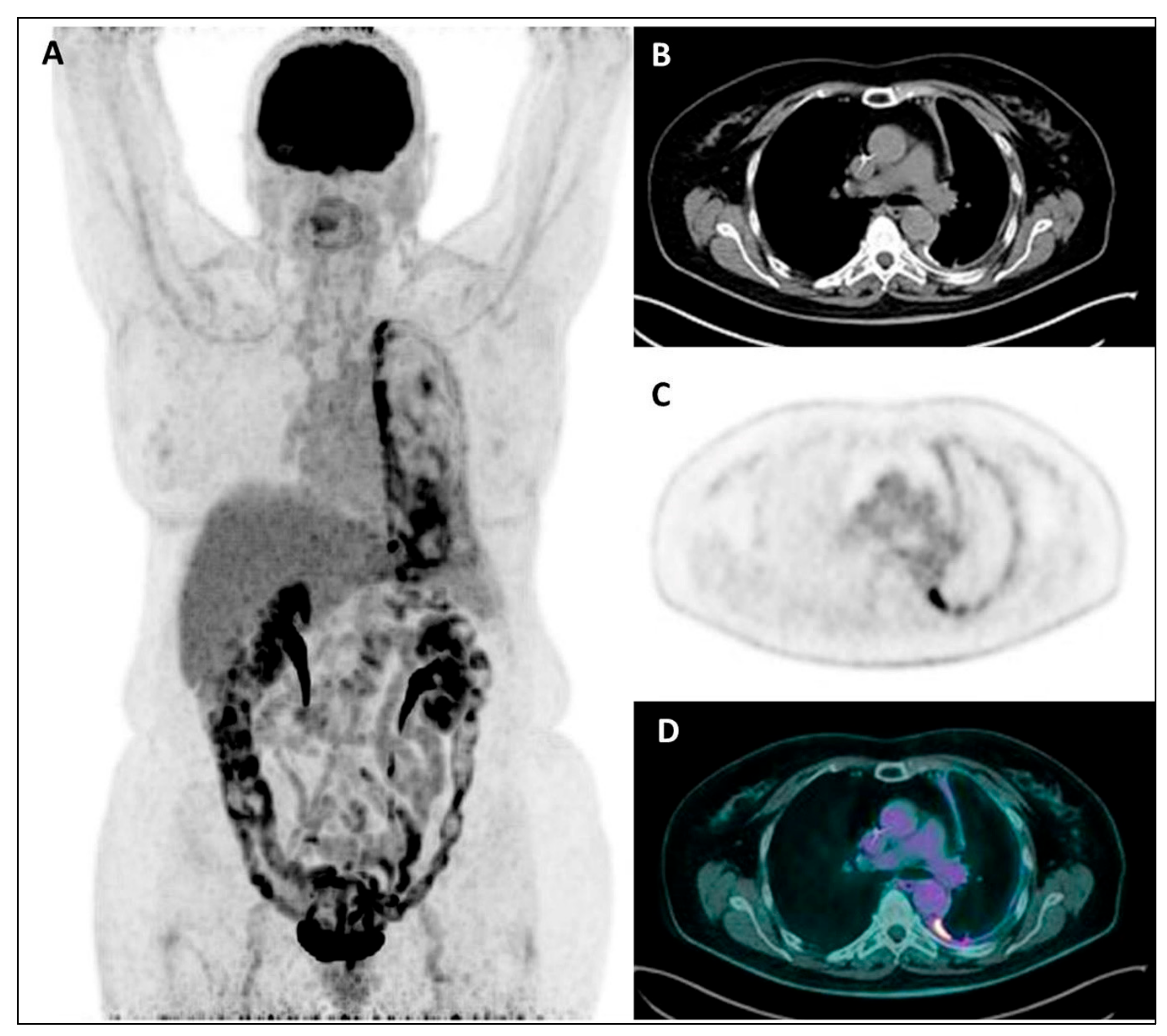 Jcm 11 00033 g004 Jcm 11 00033 g004