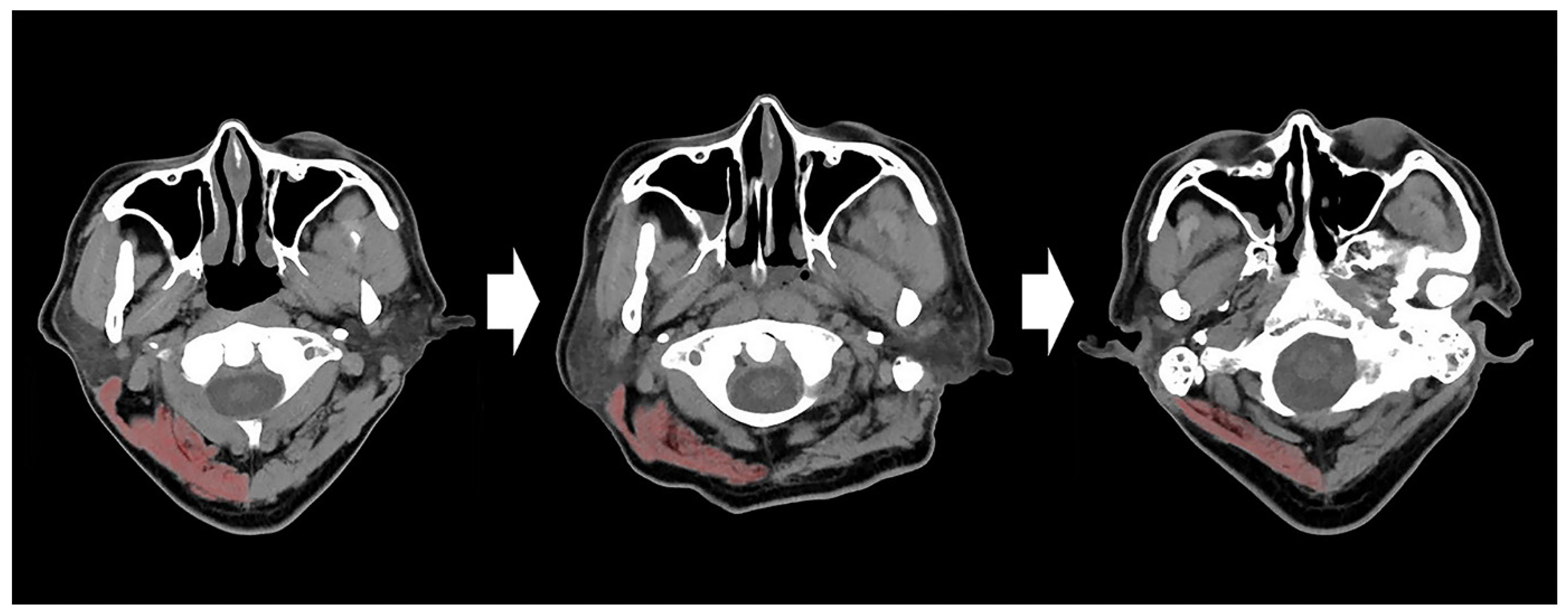 Jcm 11 00090 g001 Jcm 11 00090 g001