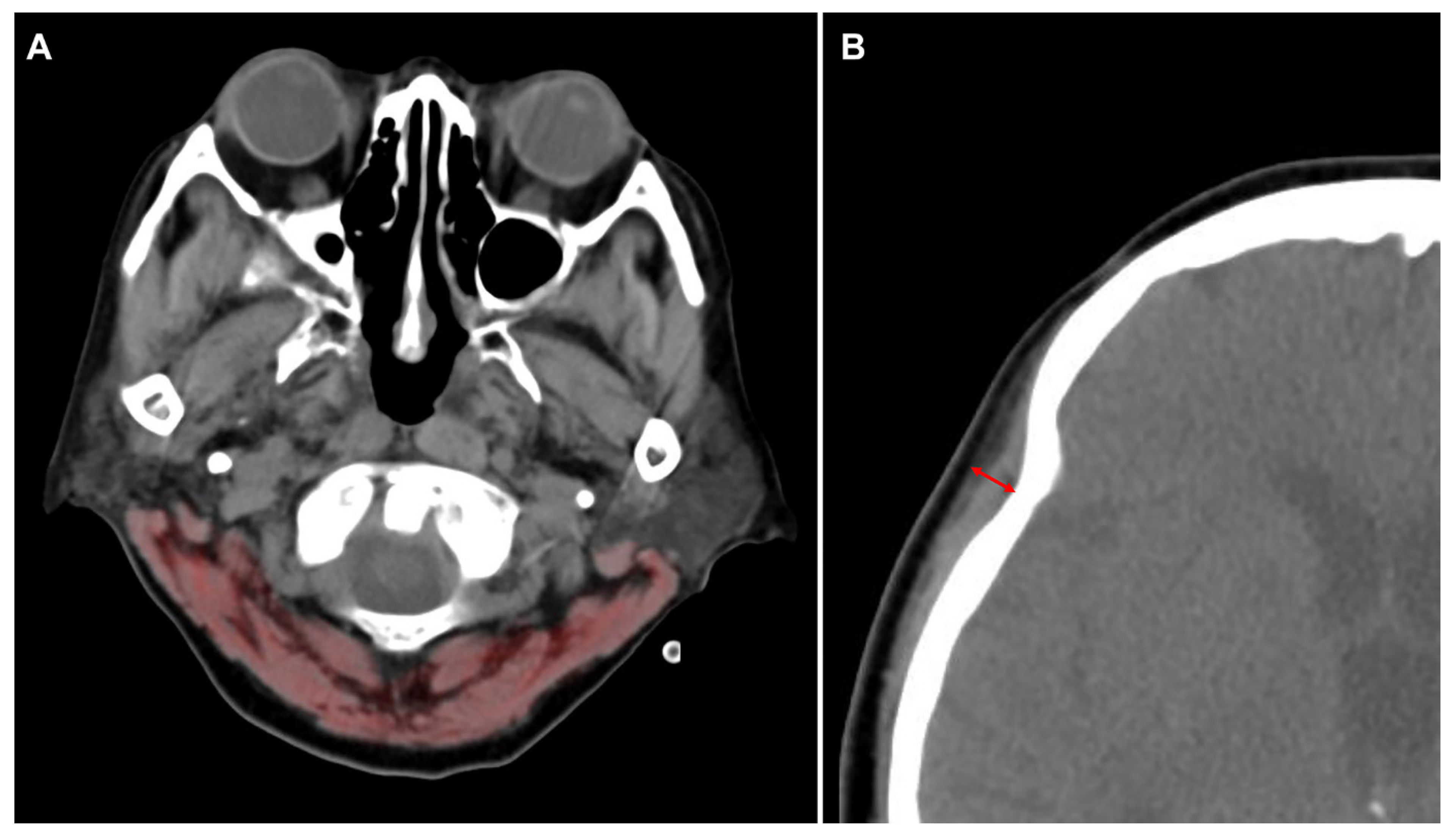Jcm 11 00090 g003 Jcm 11 00090 g003