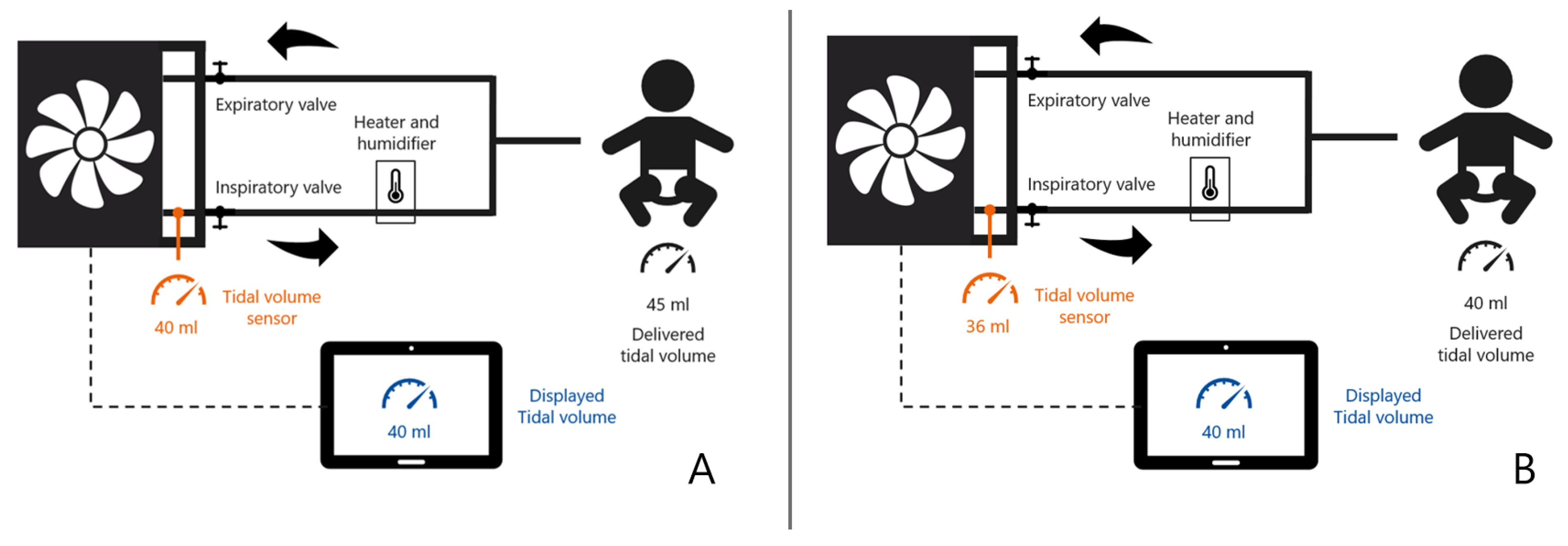 JCM | Free Full-Text | Tidal Volume in Pediatric Ventilation: Do You Get  What You See?
