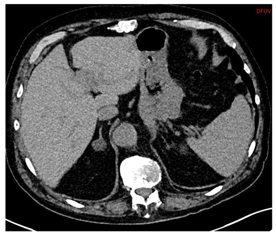 Le scanner - Centre Hypertension-Paris