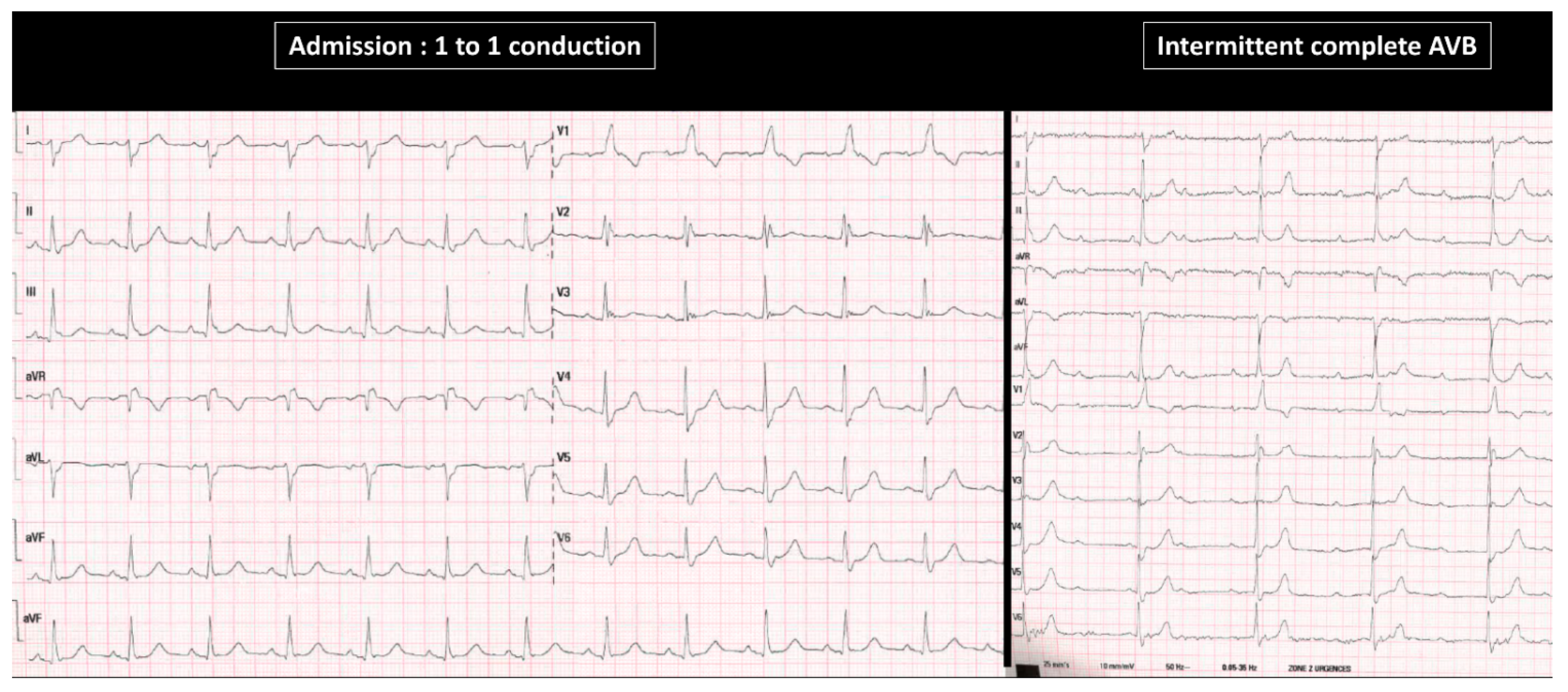Jcm 11 00449 g006 Jcm 11 00449 g006