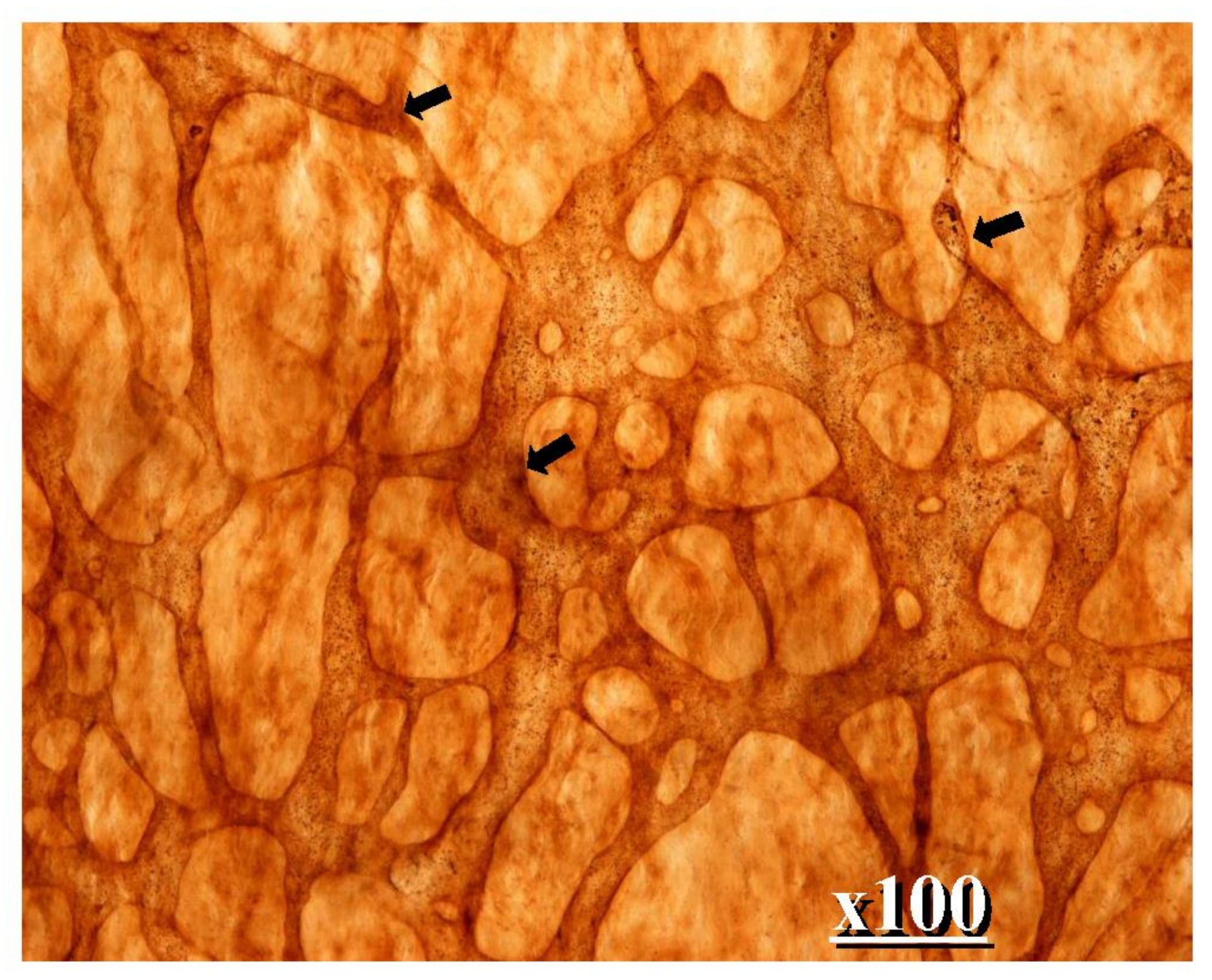 Jcm 11 00458 g003
