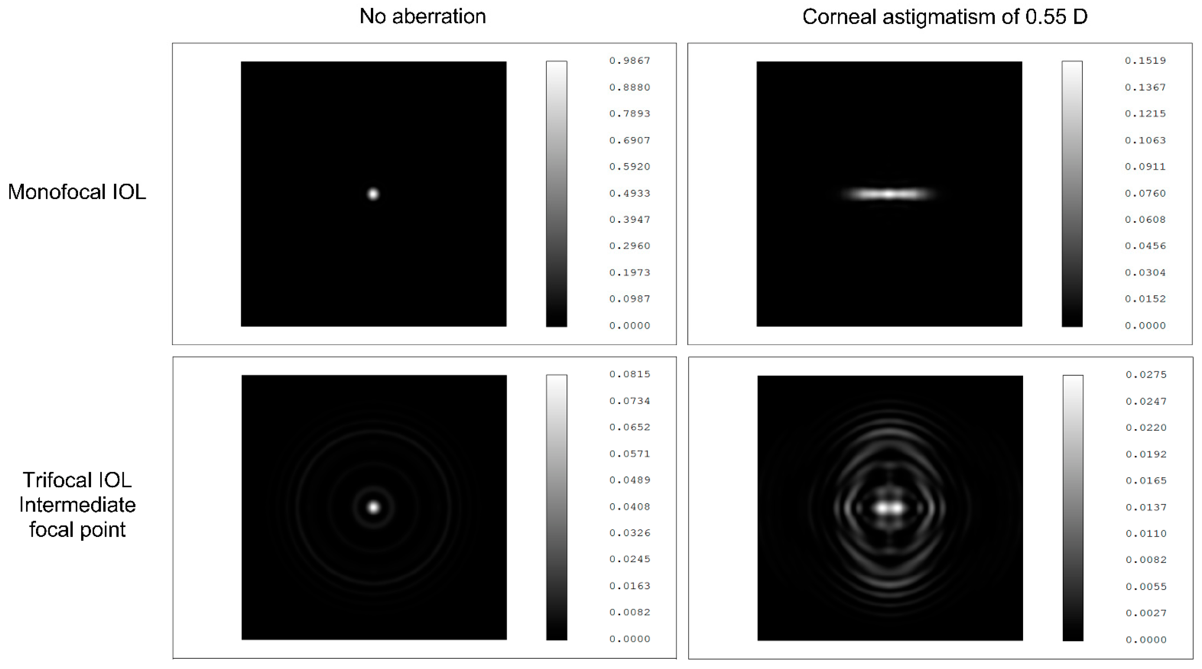 JCM | Free Full-Text | The Influence of Angle Alpha, Angle Kappa, and  Optical Aberrations on Visual Outcomes after the Implantation of a  High-Addition Trifocal IOL | HTML
