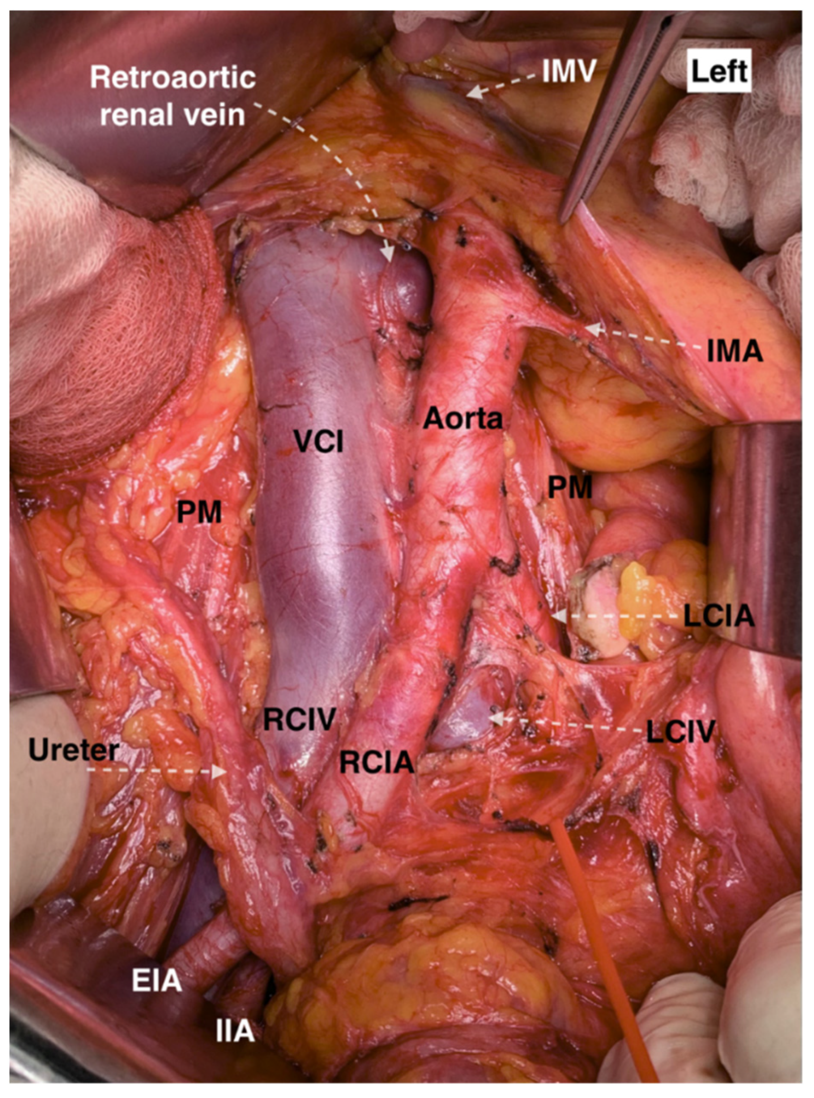 Jcm 11 00953 g015 Jcm 11 00953 g015