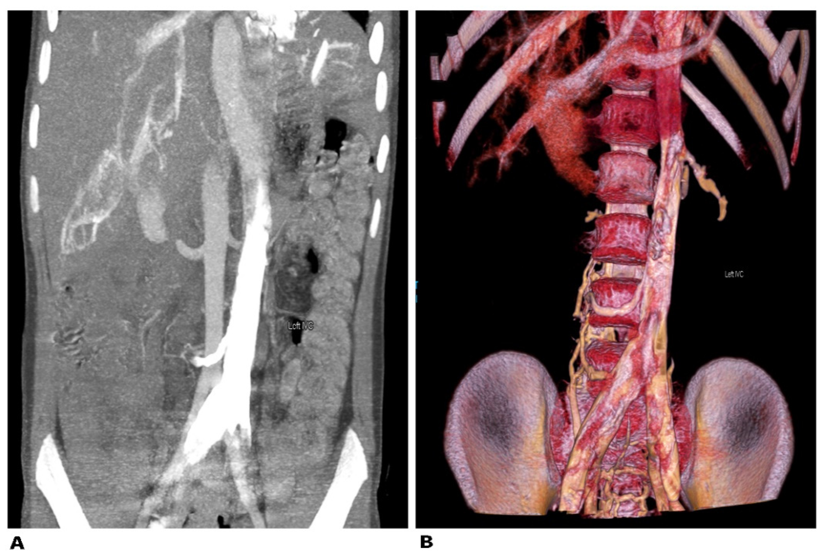 Jcm 11 00953 g017 Jcm 11 00953 g017
